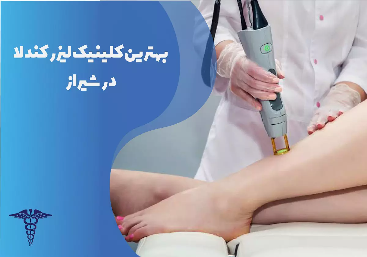10 بهترین کلینیک لیزر کندلا در شیراز + هزینه ۱۴۰۵