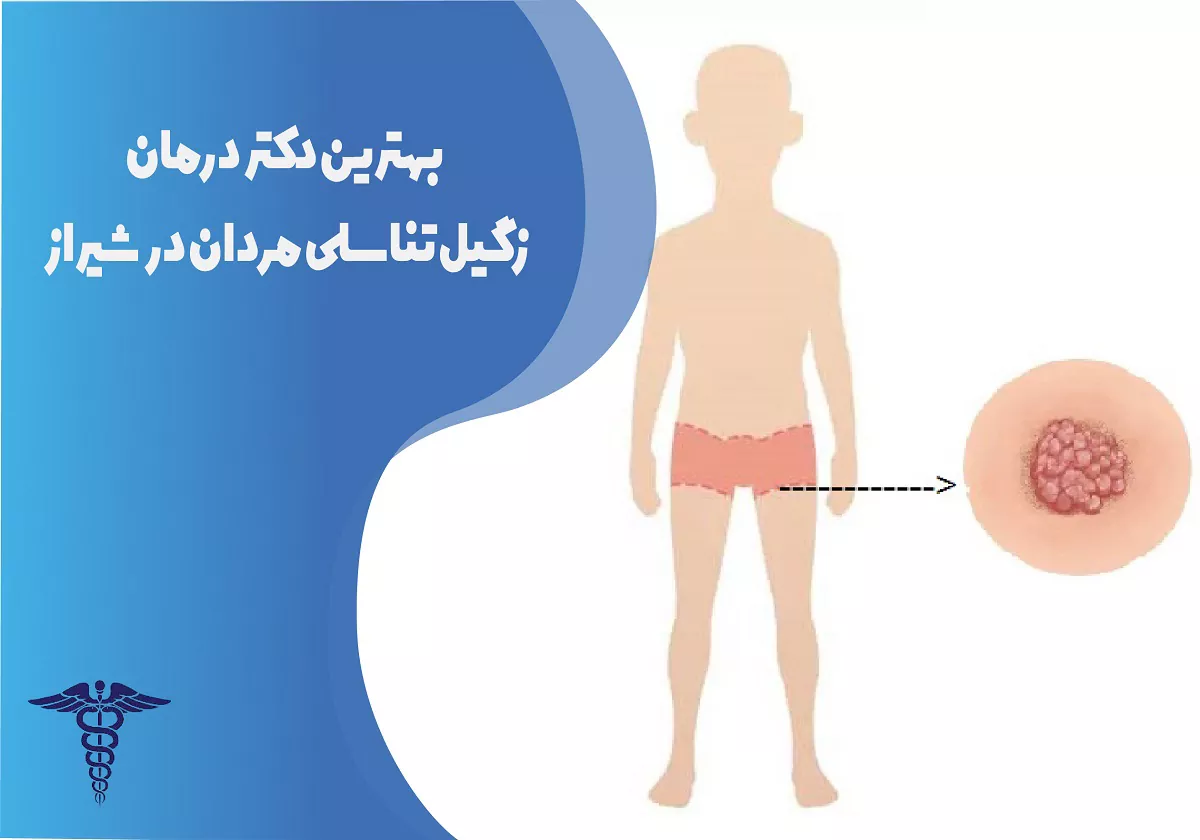 7 بهترین دکتر درمان زگیل تناسلی مردان در شیراز + هزینه 1405 - Copy