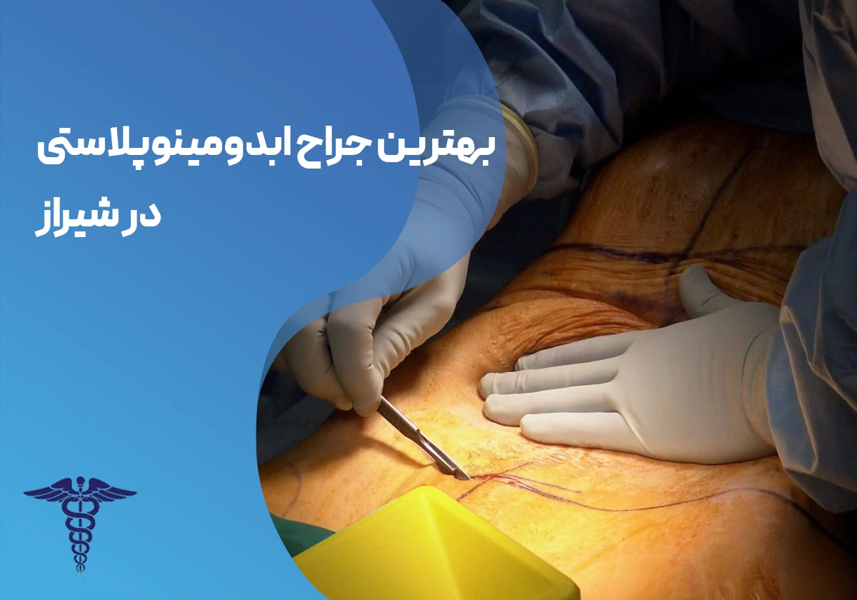 10 بهترین جراح ابدومینوپلاستی در شیراز + هزینه ۱۴۰۵