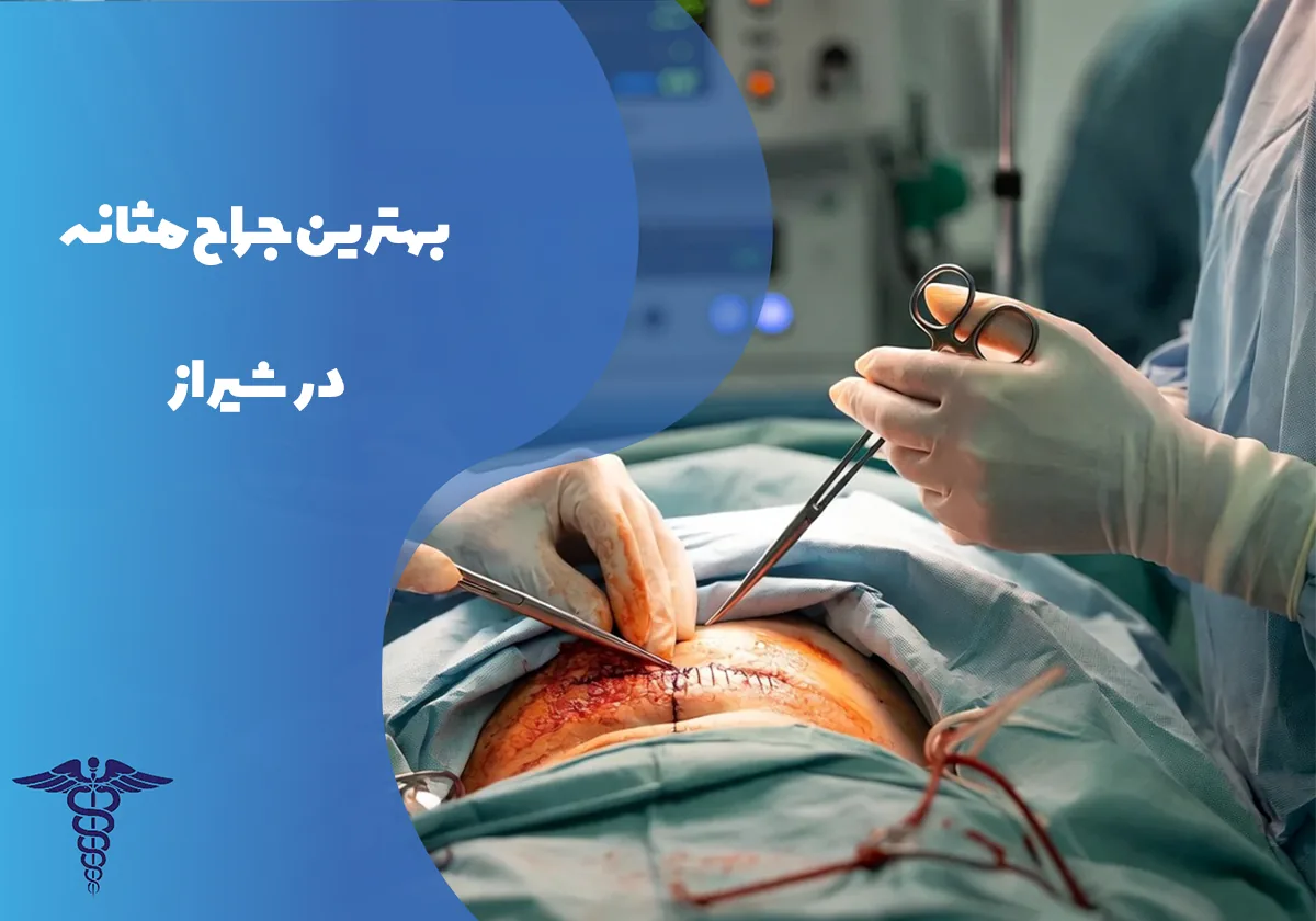 معرفی 12 جراح برتر مثانه در شیراز – بهترین جراح مثانه شیراز کیست؟