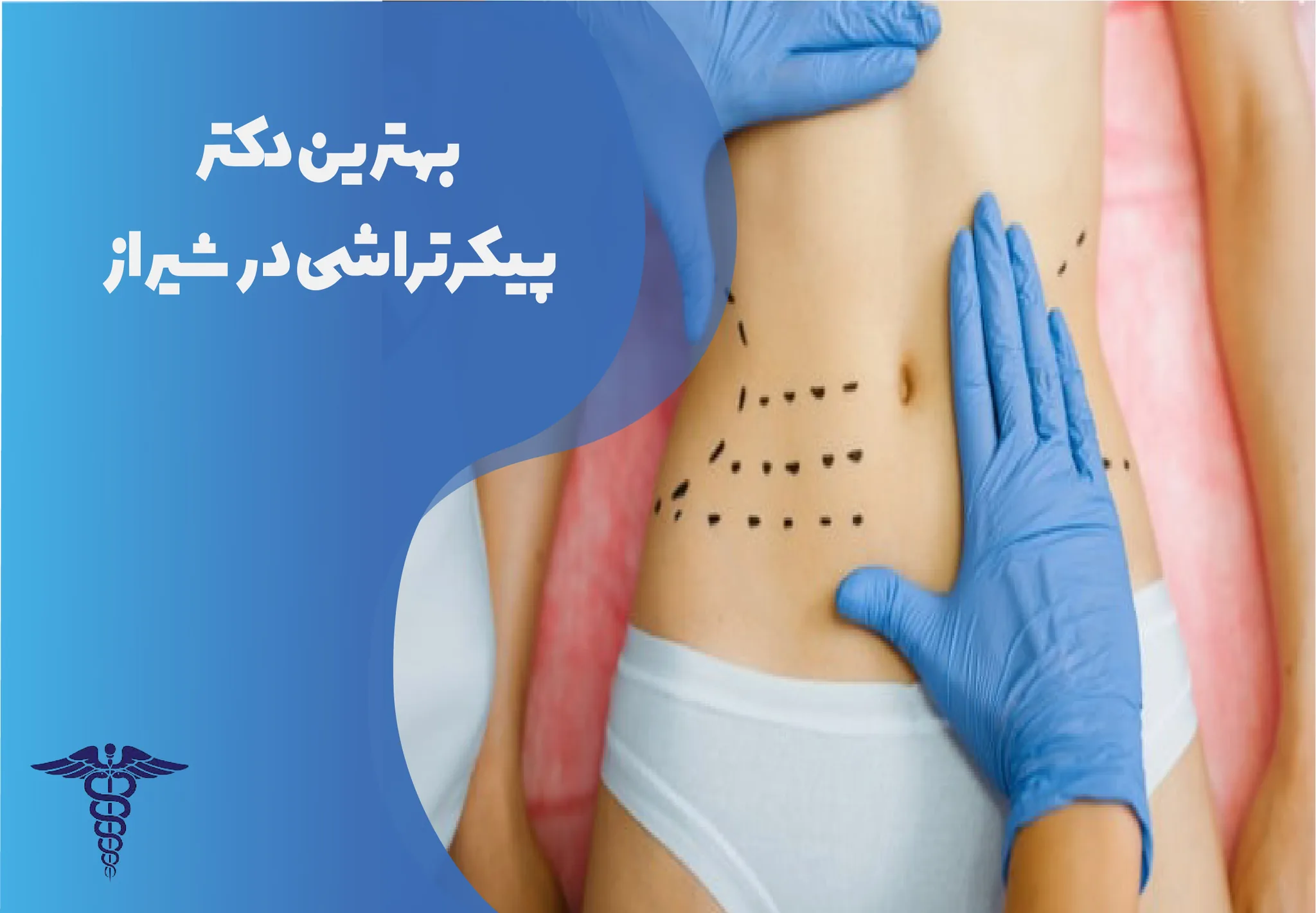 10 بهترین دکتر پیکرتراشی در شیراز + اینستاگرام و هزینه ۱۴۰۵