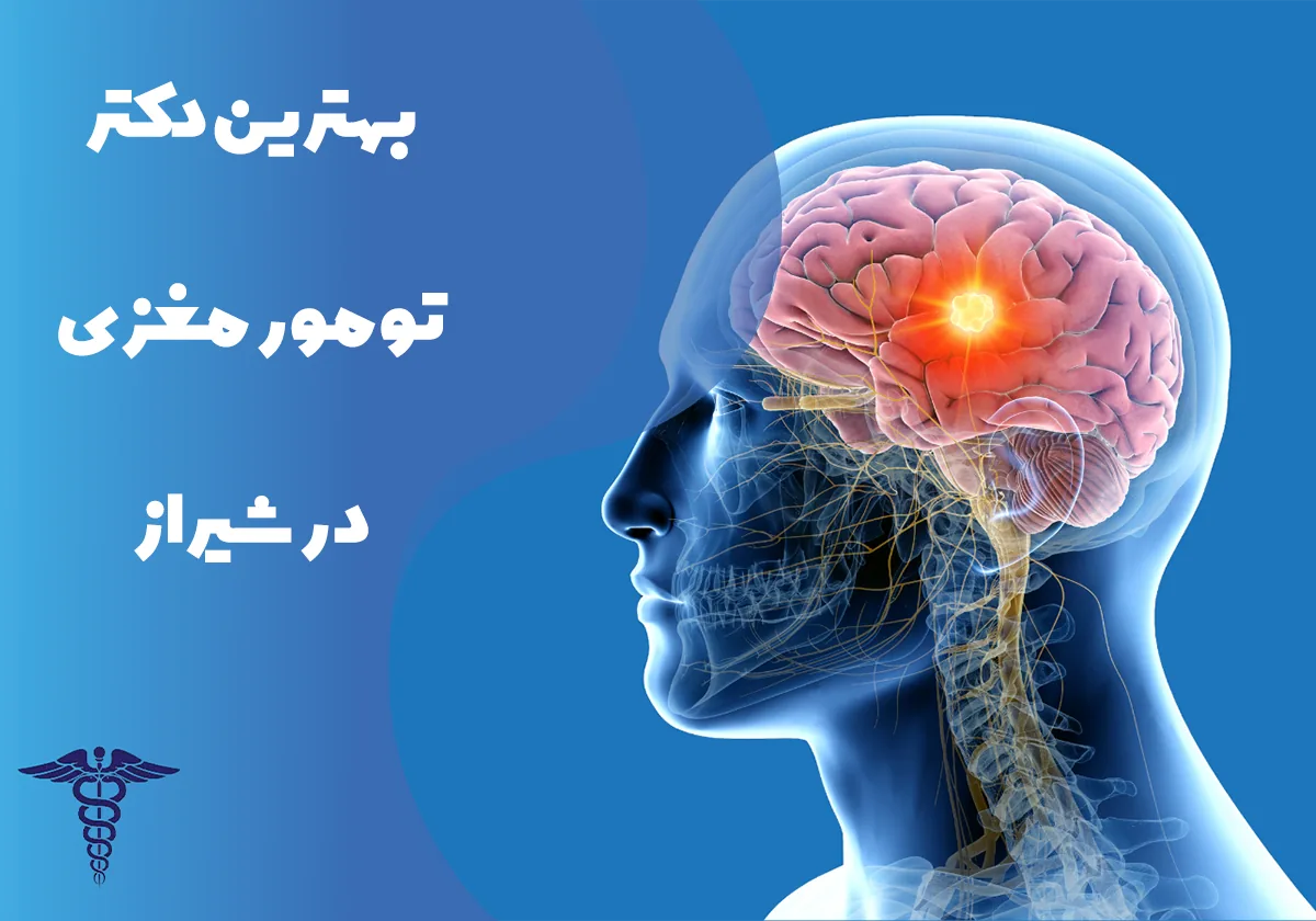 معرفی 25 دکتر برتر تومور مغزی در شیراز - بهترین دکتر تومور مغزی در شیراز کیست؟