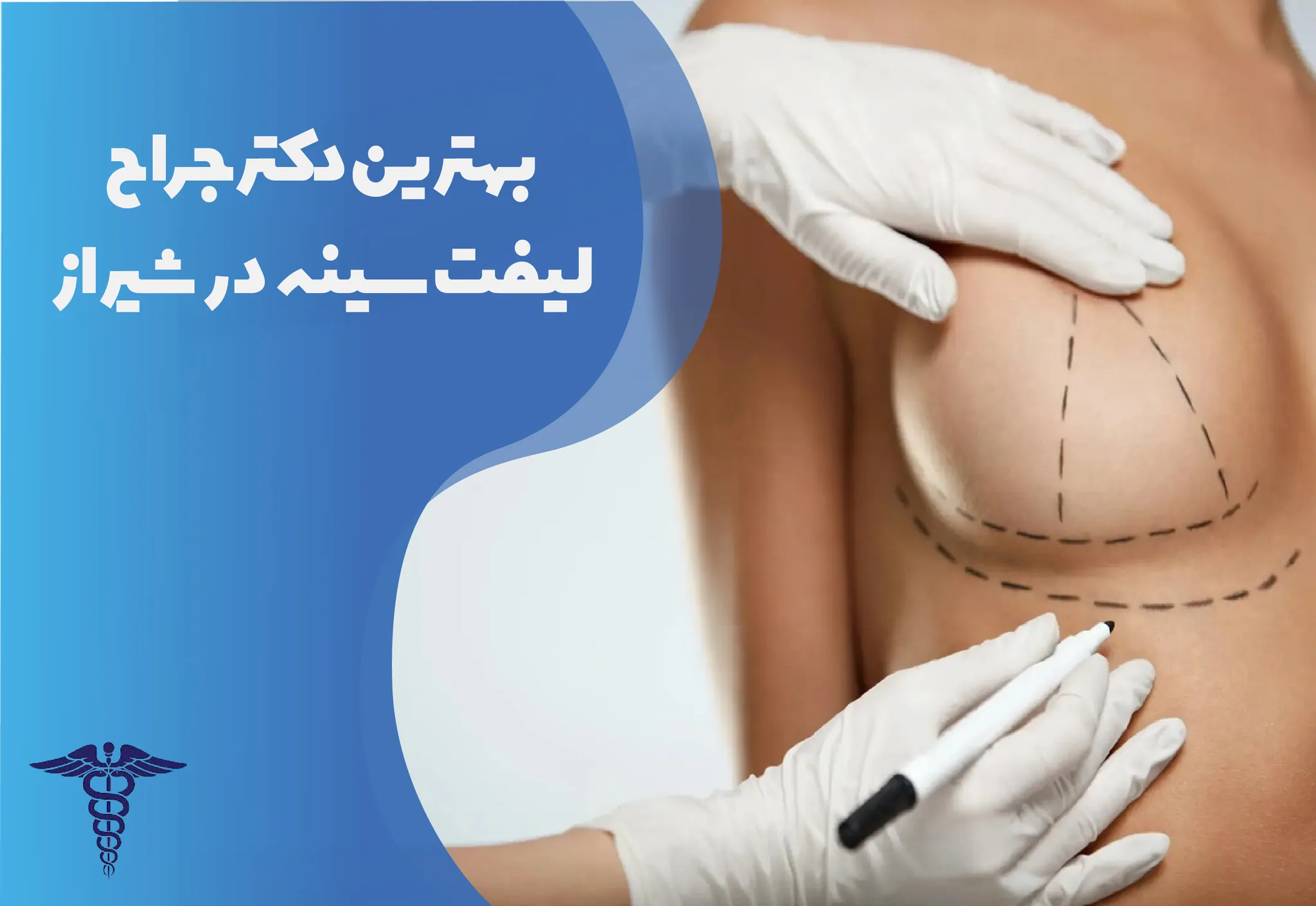 ۱۰ بهترین دکتر لیفت سینه در شیراز + هزینه ۱۴۰۵