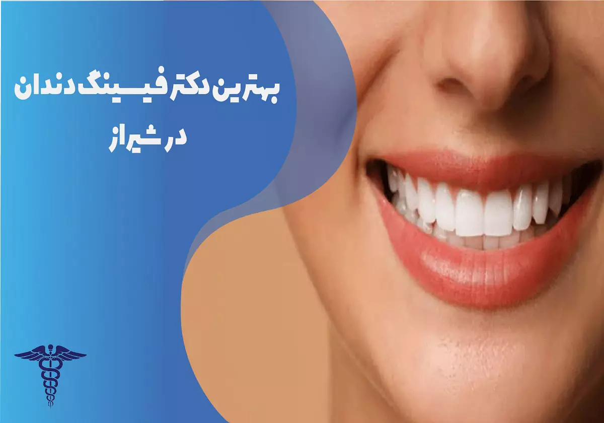 بهترین دکتر فیسینگ دندان در شیراز