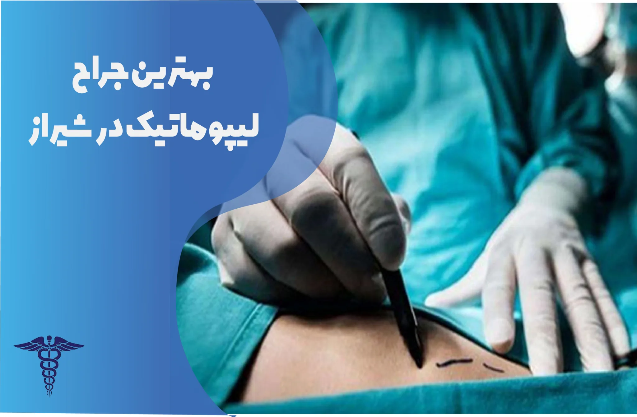 10 بهترین جراح لیپوماتیک در شیراز + هزینه ۱۴۰۵