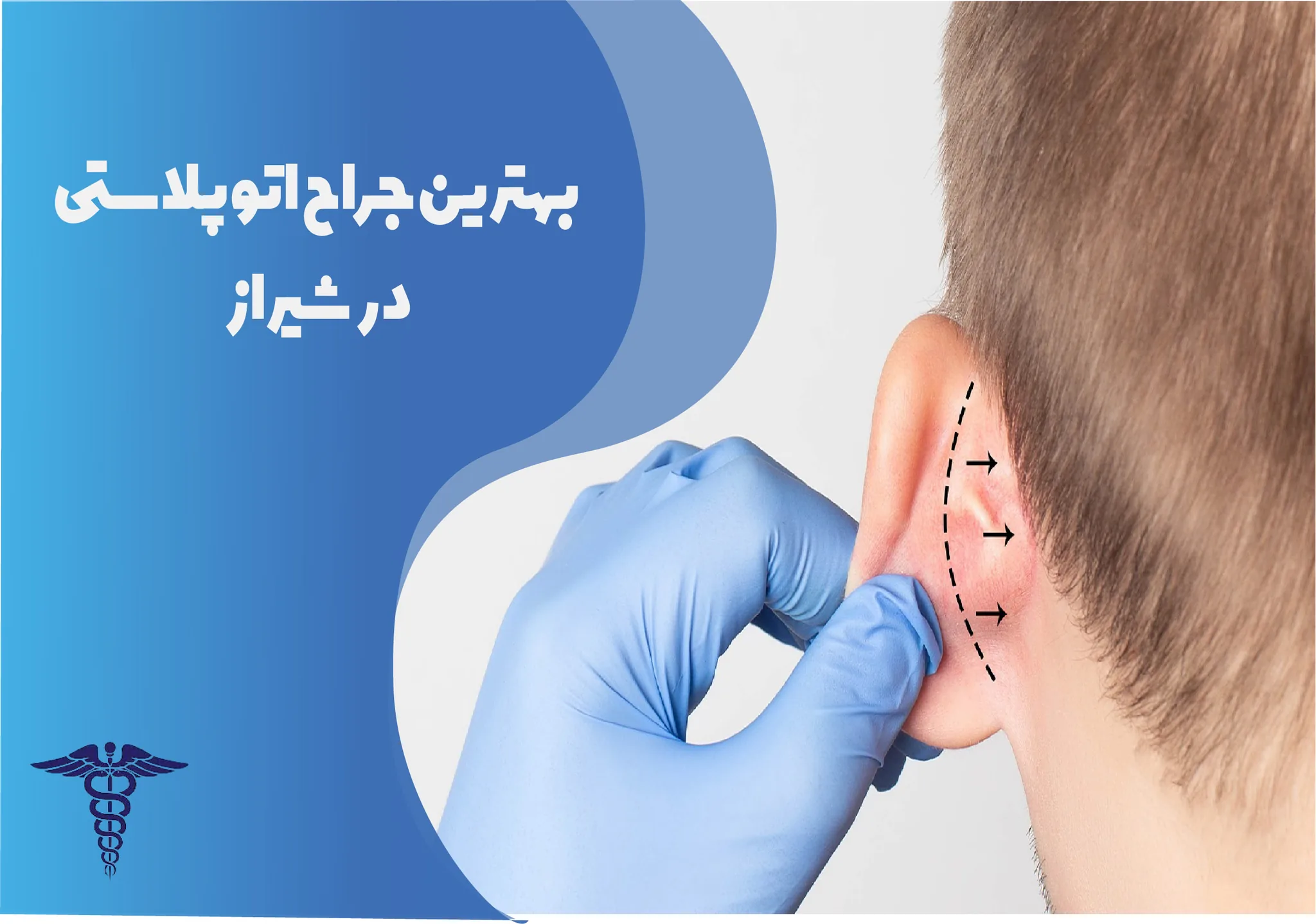معرفی 12 جراح برتر اتوپلاستی در شیراز – بهترین جراح اتوپلاستی شیراز کیست؟