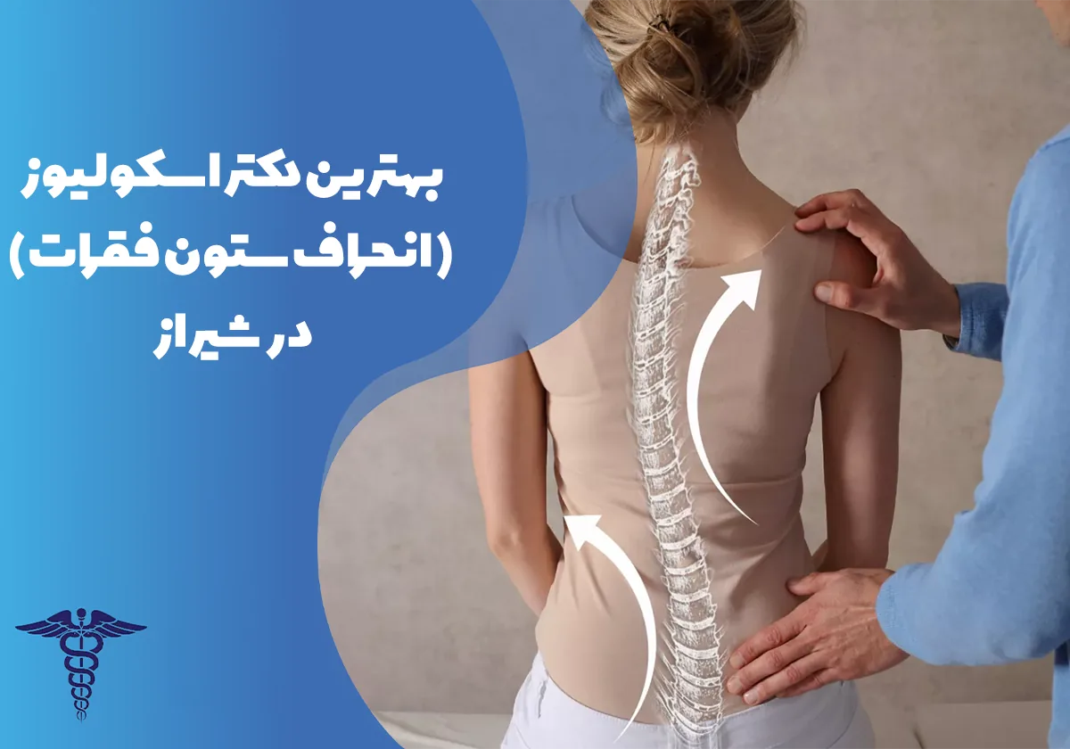 20 تا از بهترین دکتر اسکولیوز (انحراف ستون فقرات) در شیراز