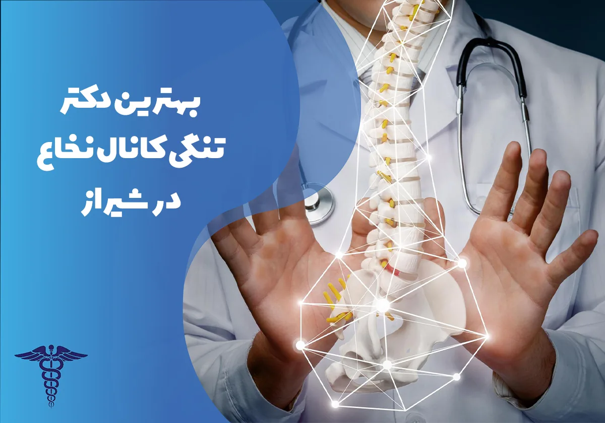 20 تا از بهترین دکتر تنگی کانال نخاع در شیراز
