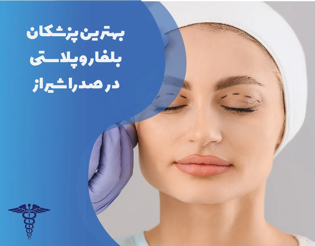 معرفی 7 متخصص بلفاروپلاستی برتر در صدرا شیراز- بهترین متخصص بلفاروپلاستی در صدرا شیراز کیست؟
