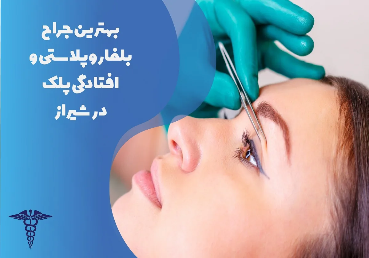 10 بهترین جراح بلفاروپلاستی در شیراز + هزینه ۱۴۰۵