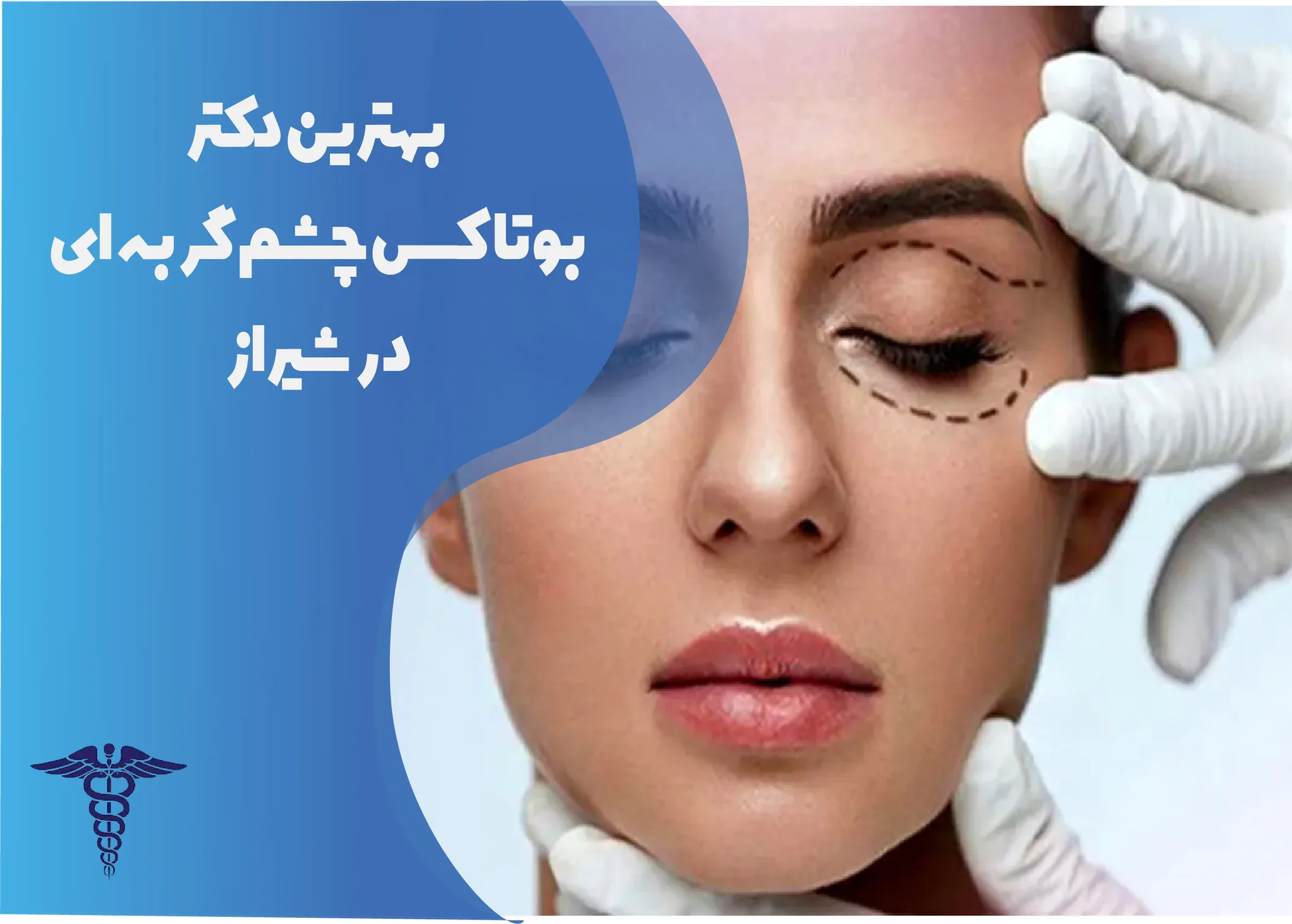 معرفی 12 دکتر برتر بوتاکس چشم گربه‌ای در شیراز – بهترین دکتر بوتاکس چشم گربه‌ای شیراز کیست؟