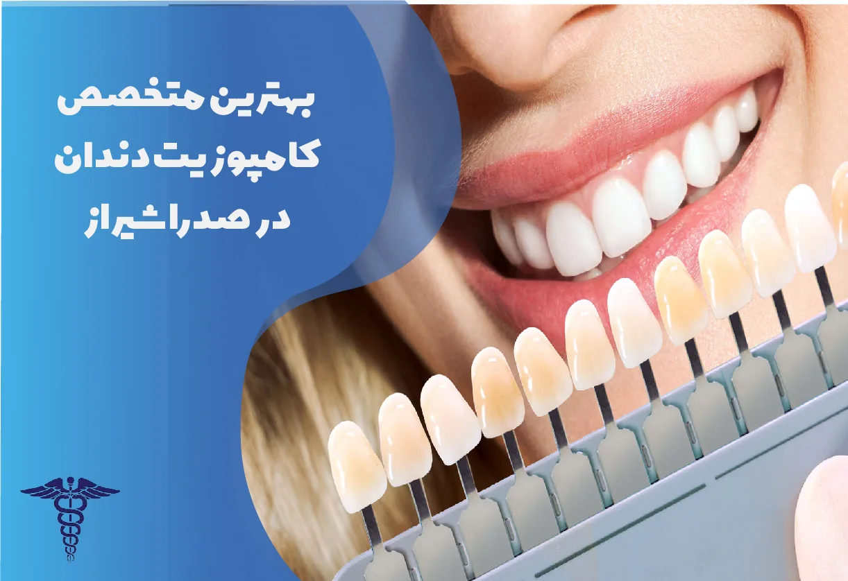 ۱۵ بهترین متخصص کامپوزیت در صدرا + هزینه ۱۴۰۵