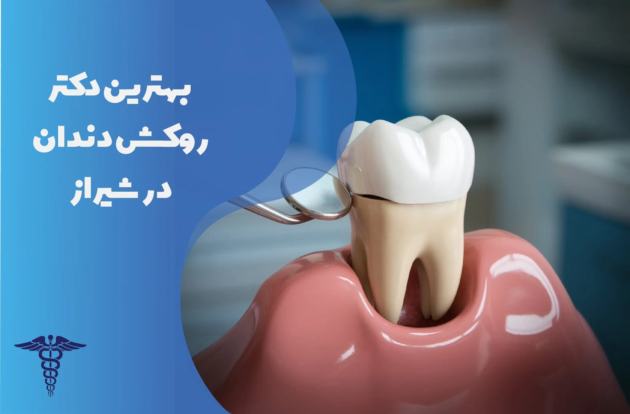 معرفی 31 بهترین دکتر روکش دندان در شیراز - بهترین دندانپزشک روکش دندان شیراز کیست؟