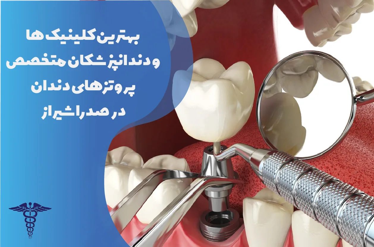معرفی ۱۱ متخصص برتر پروتزهای دندان در صدرا شیراز - بهترین متخصص پروتزهای دندان در صدرا شیراز کیست؟
