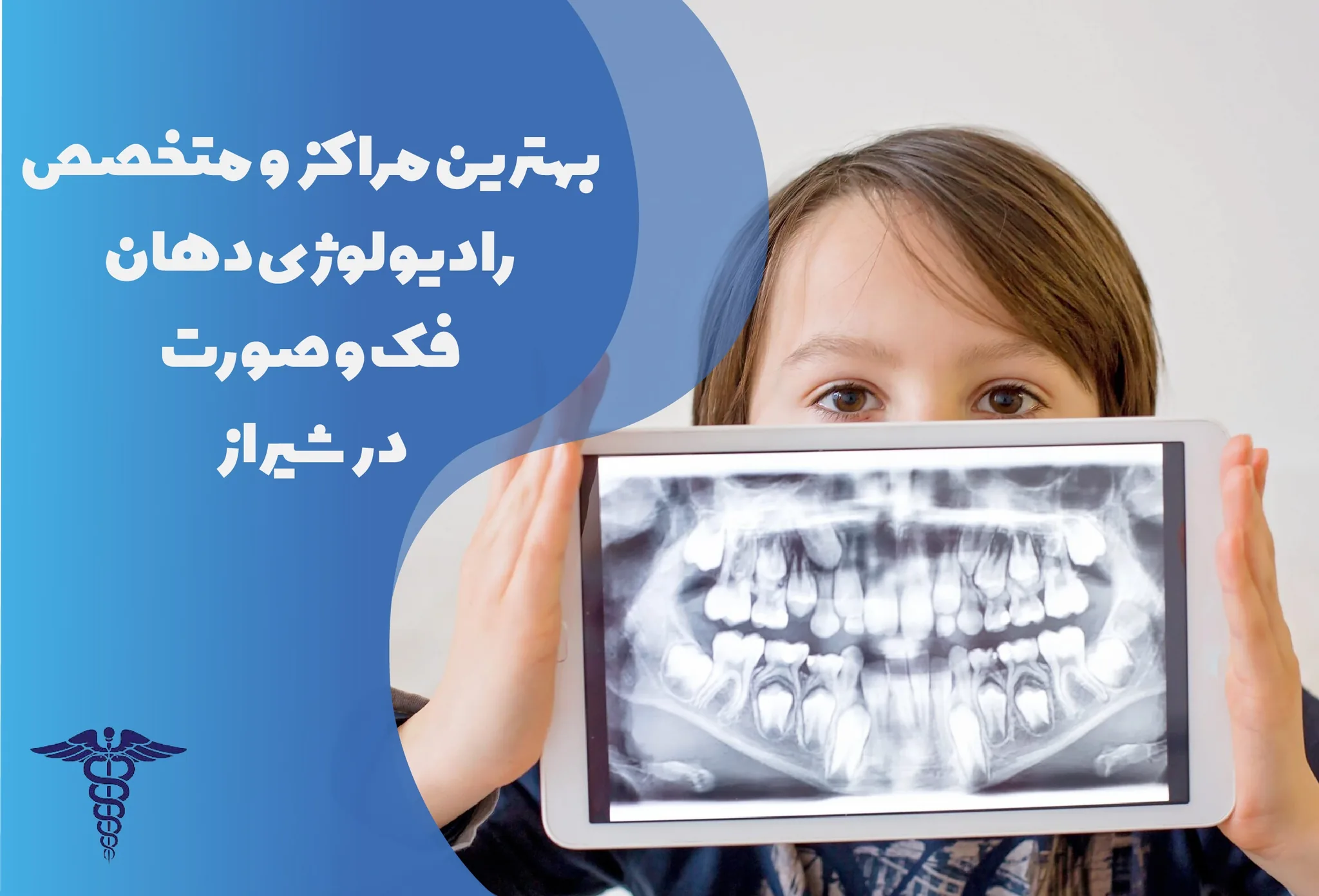 معرفی 18 مرکز رادیولوژی دهان، فک و صورت برتر شیراز- بهترین رادیولوژی دهان، فک و صورت شیراز کجاست؟