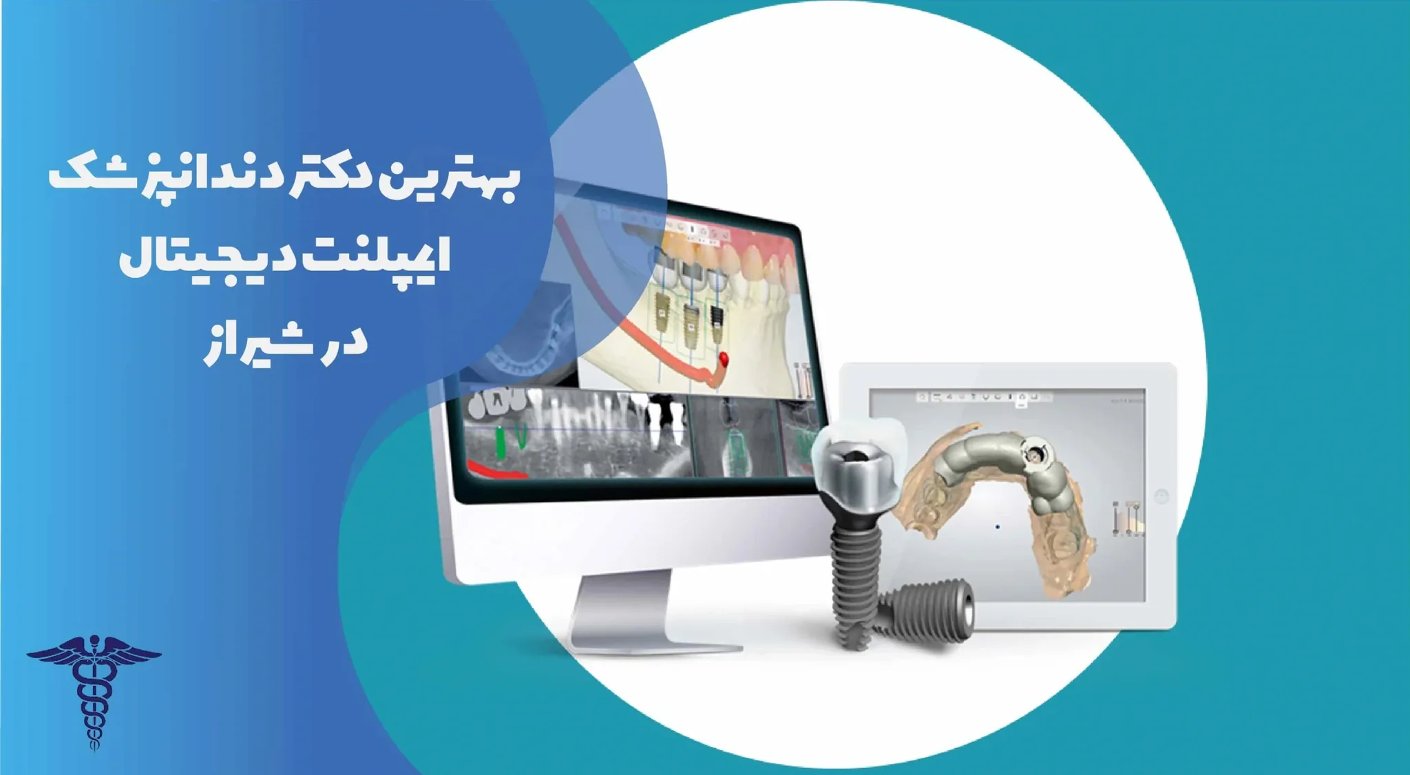 20 تا از بهترین دندانپزشک ایمپلنت دیجیتال در شیراز