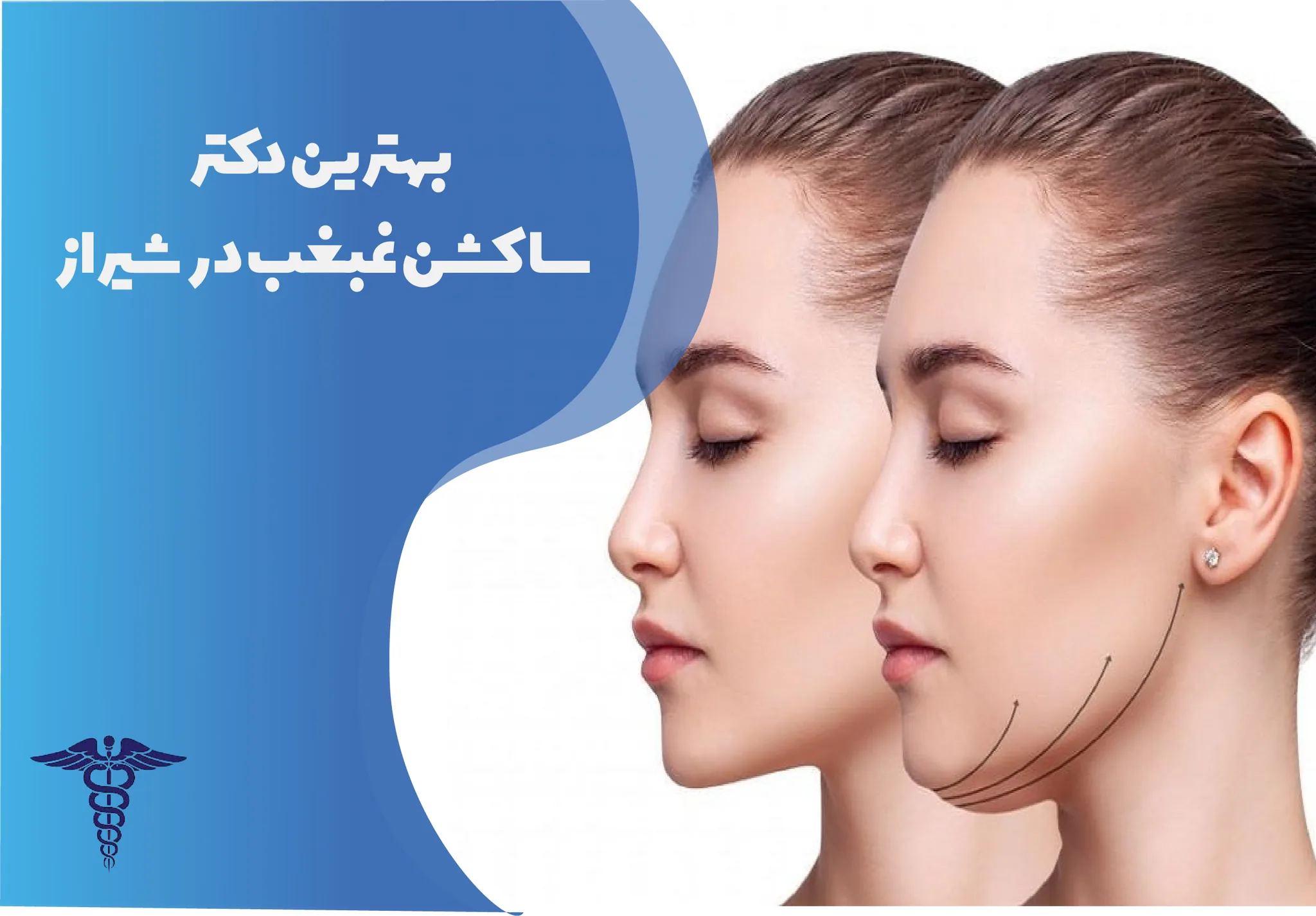 معرفی 12 دکتر برتر ساکشن غبغب در شیراز – بهترین دکتر ساکشن غبغب شیراز کیست؟