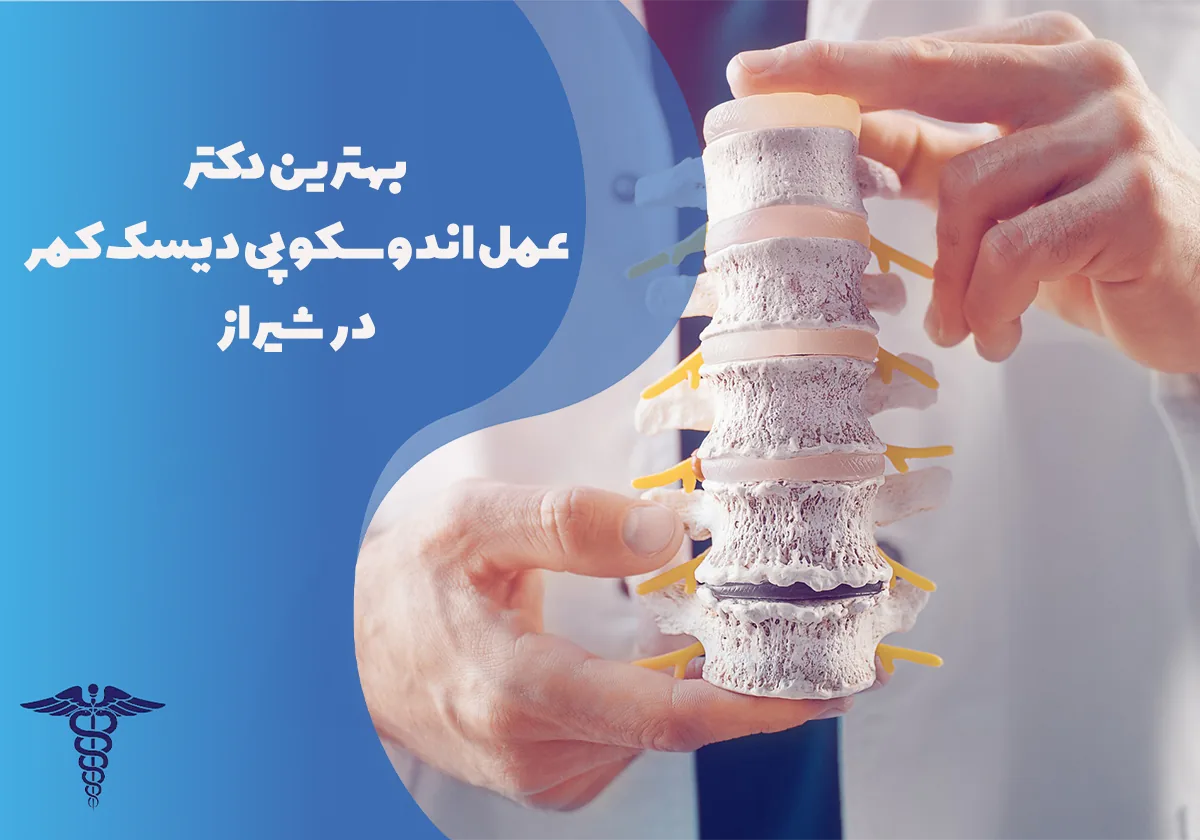 بهترین دکتر عمل اندوسکوپی دیسک کمر در شیراز