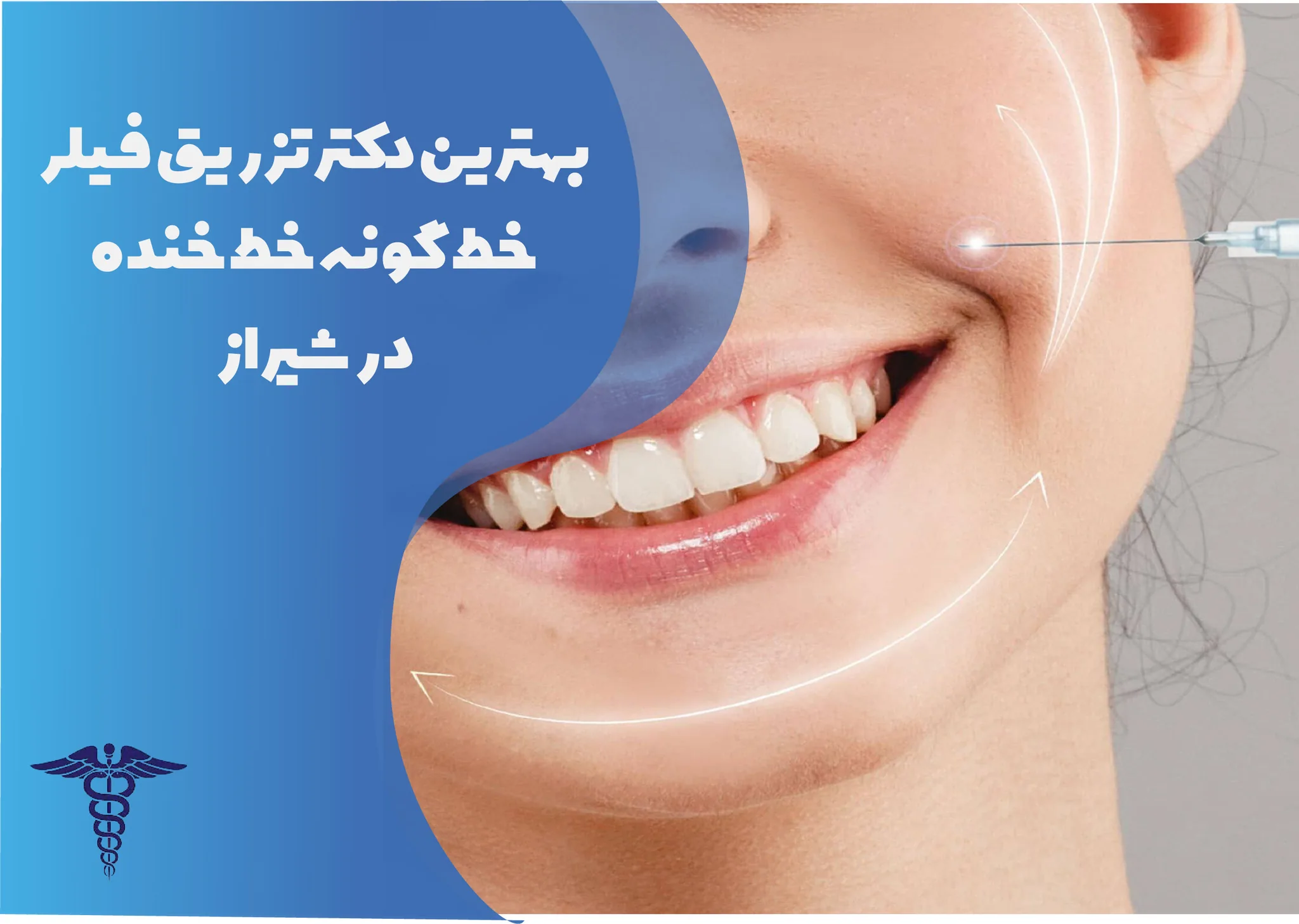 معرفی 12 دکتر برتر تزریق فیلر خط گونه و خط خنده در شیراز – بهترین دکتر تزریق فیلر خط گونه و خط خنده شیراز کیست؟