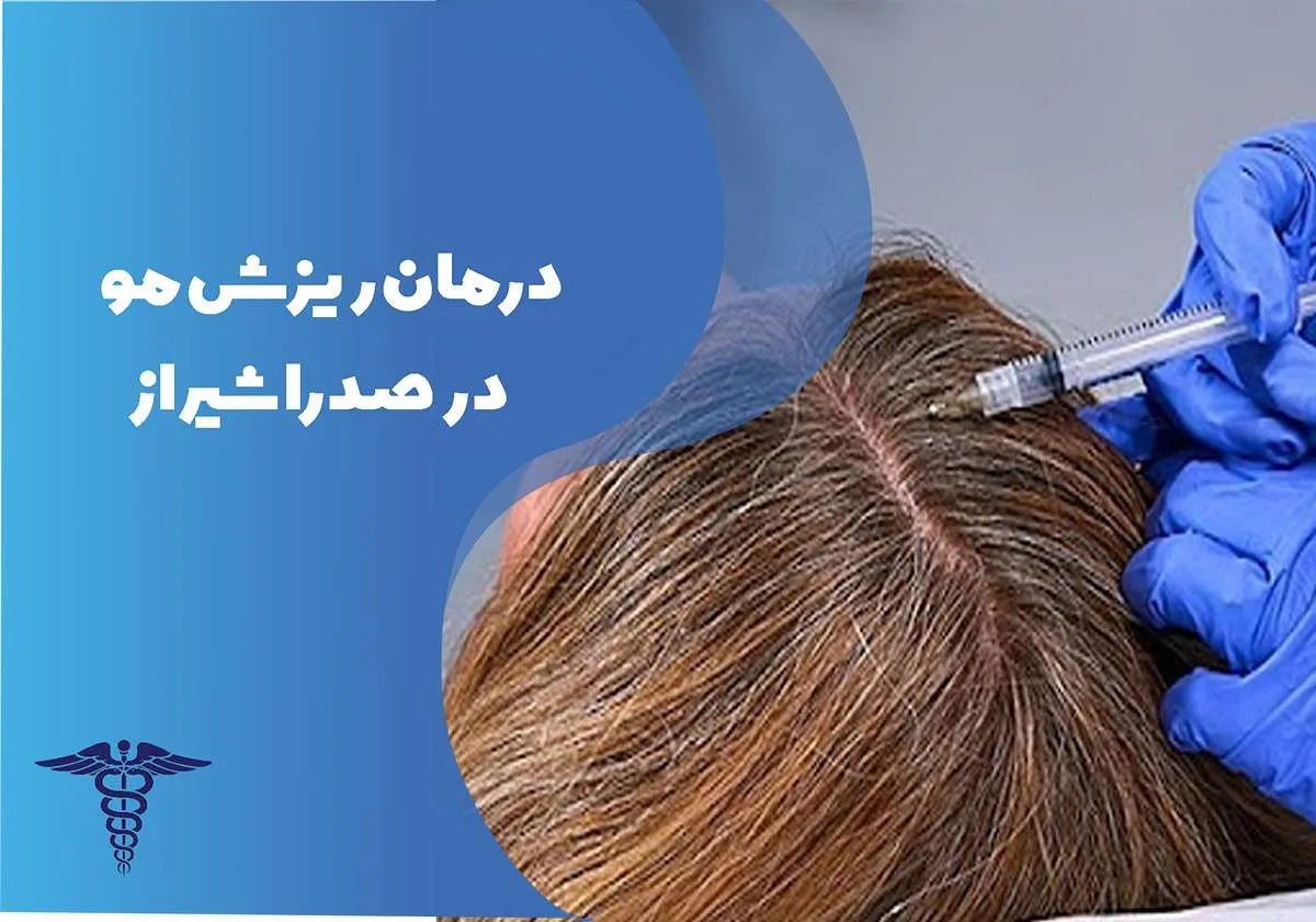 معرفی 8 مرکز برتر درمان ریزش مو در صدرا شیراز - بهترین مرکز درمان ریزش مو در صدرا شیراز کجاست؟