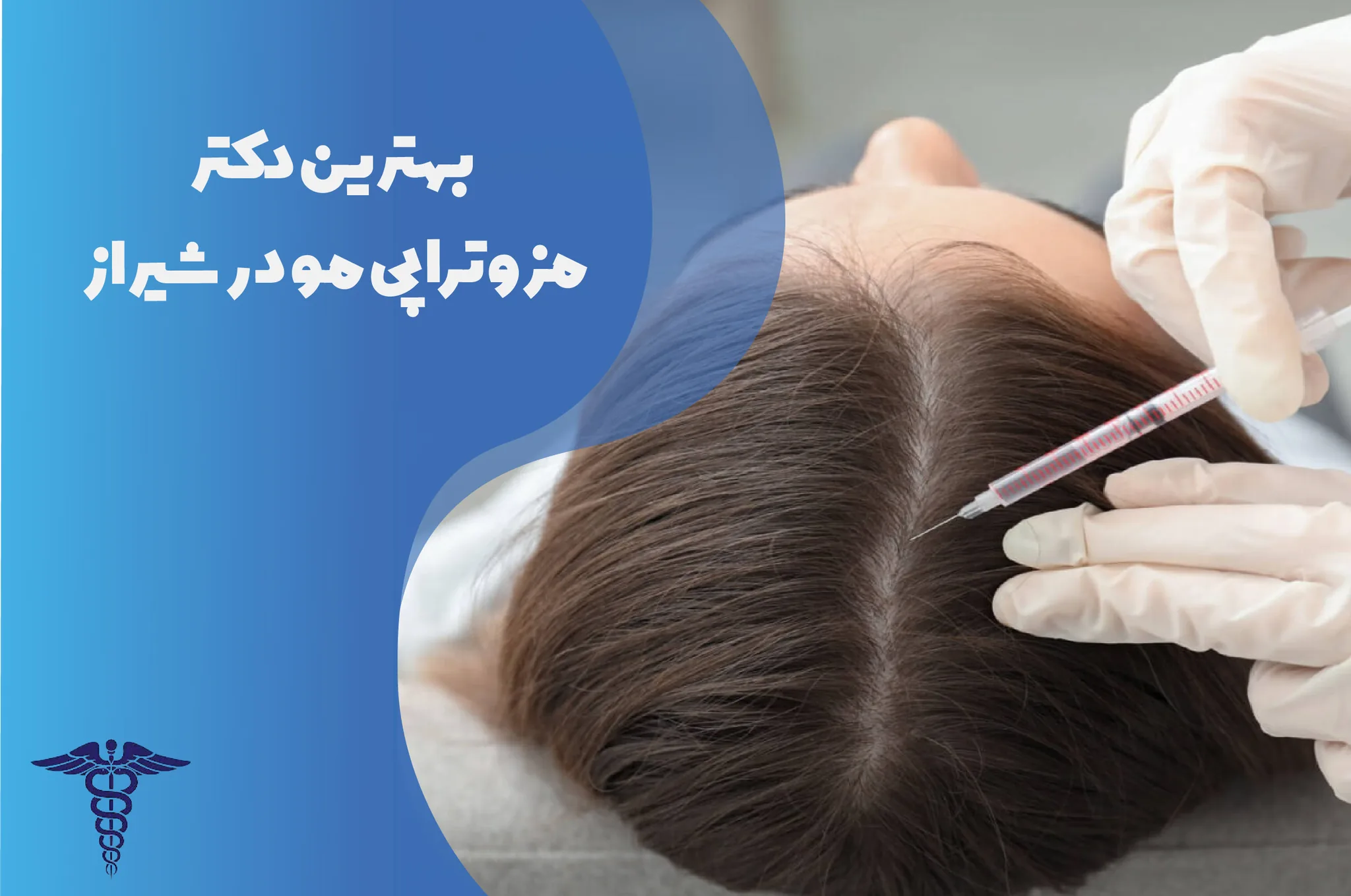 معرفی 12 دکتر برتر مزوتراپی مو در شیراز – بهترین دکتر مزوتراپی مو شیراز کیست؟