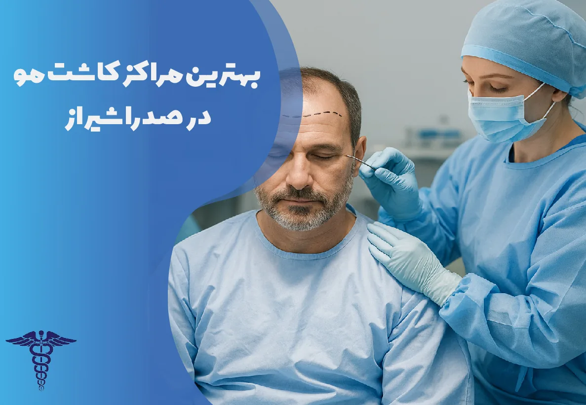 بهترین مراکز کاشت مو در صدرا شیراز