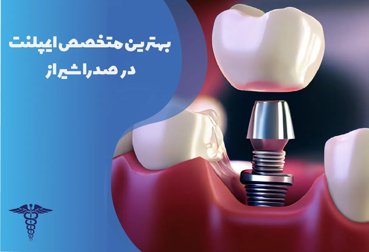 6 بهترین متخصص ایمپلنت دندان در صدرا + هزینه ۱۴۰۵