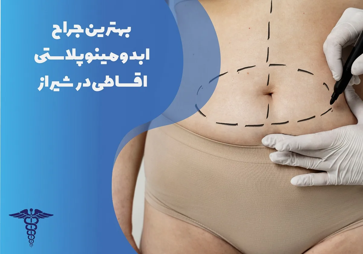 5 بهترین جراح ابدومینوپلاستی اقساطی در شیراز + شرایط و هزینه ۱۴۰۵