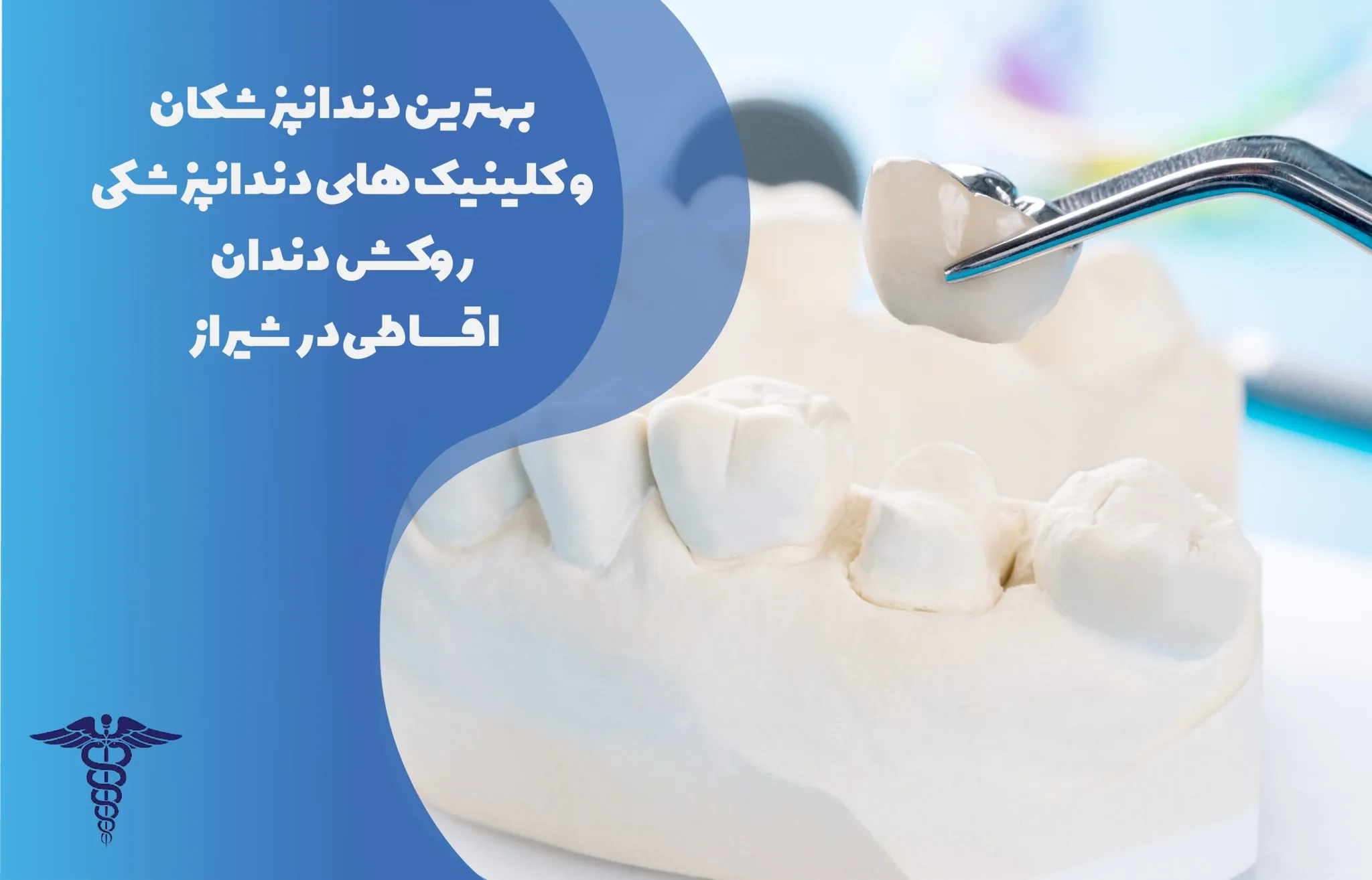 معرفی 21 مرکز روکش دندان اقساطی در شیراز- بهترین مرکز روکش دندان اقساطی شیراز کجاست؟