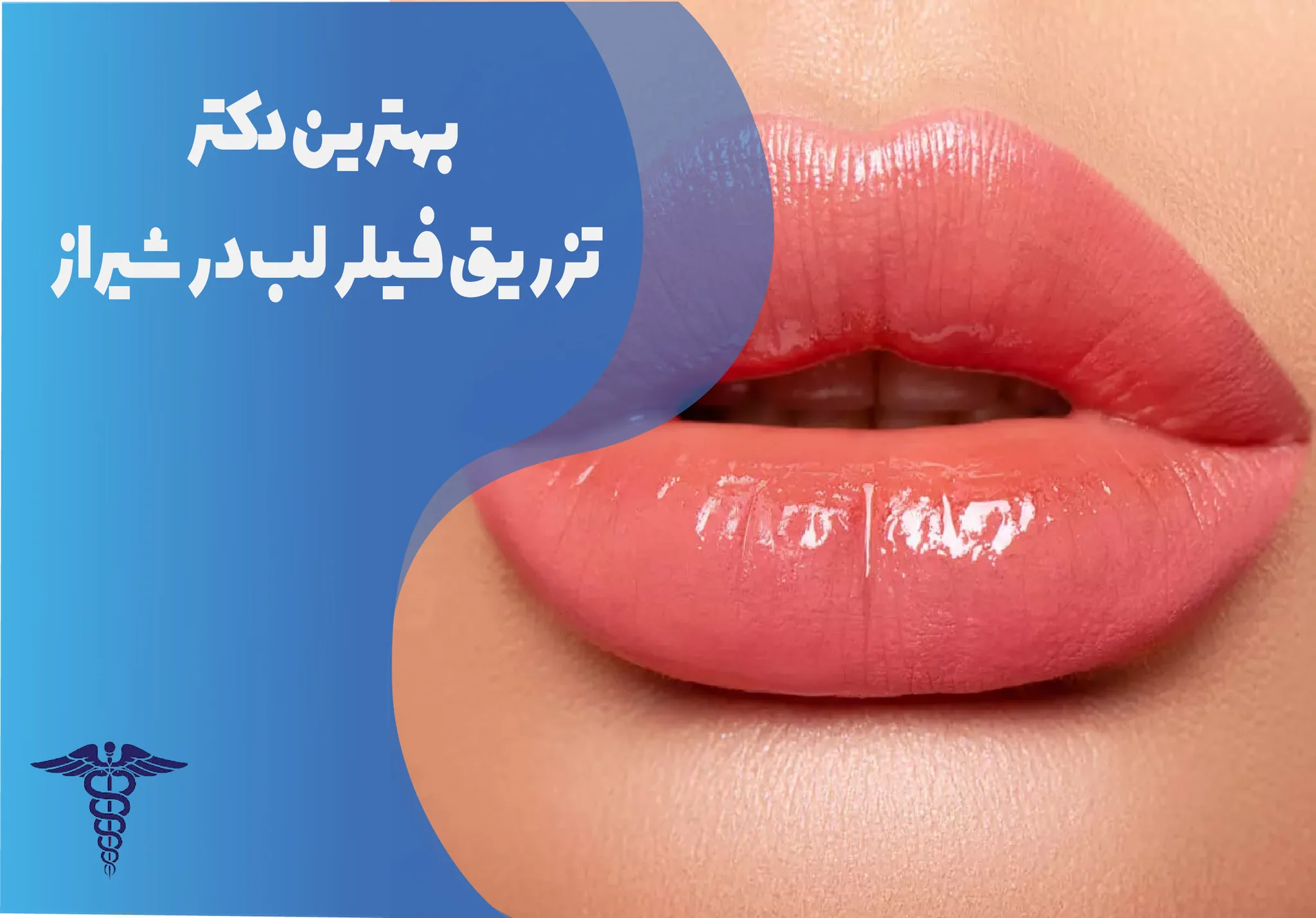 معرفی 12 دکتر برتر تزریق فیلر لب در شیراز – بهترین دکتر تزریق فیلر لب شیراز کیست؟