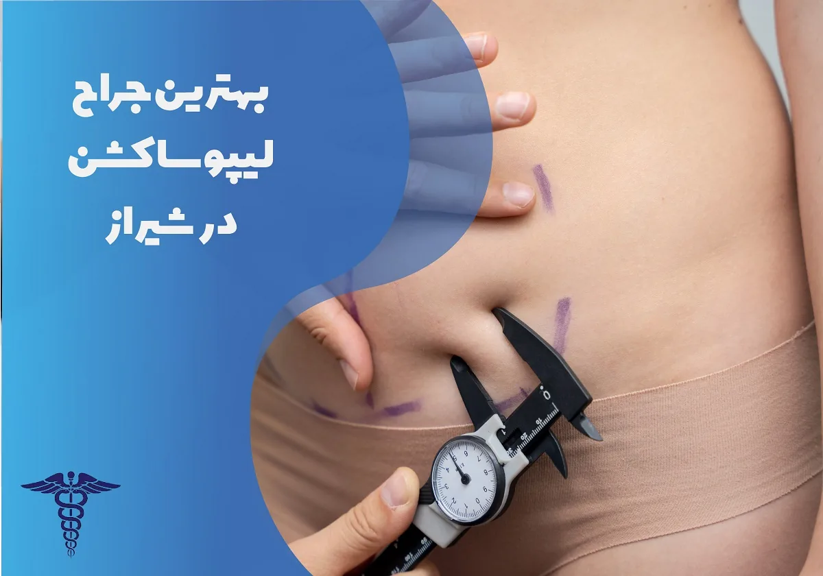معرفی 12 جراح برتر لیپوساکشن در شیراز + اینستاگرام و قیمت ۱۴۰۵