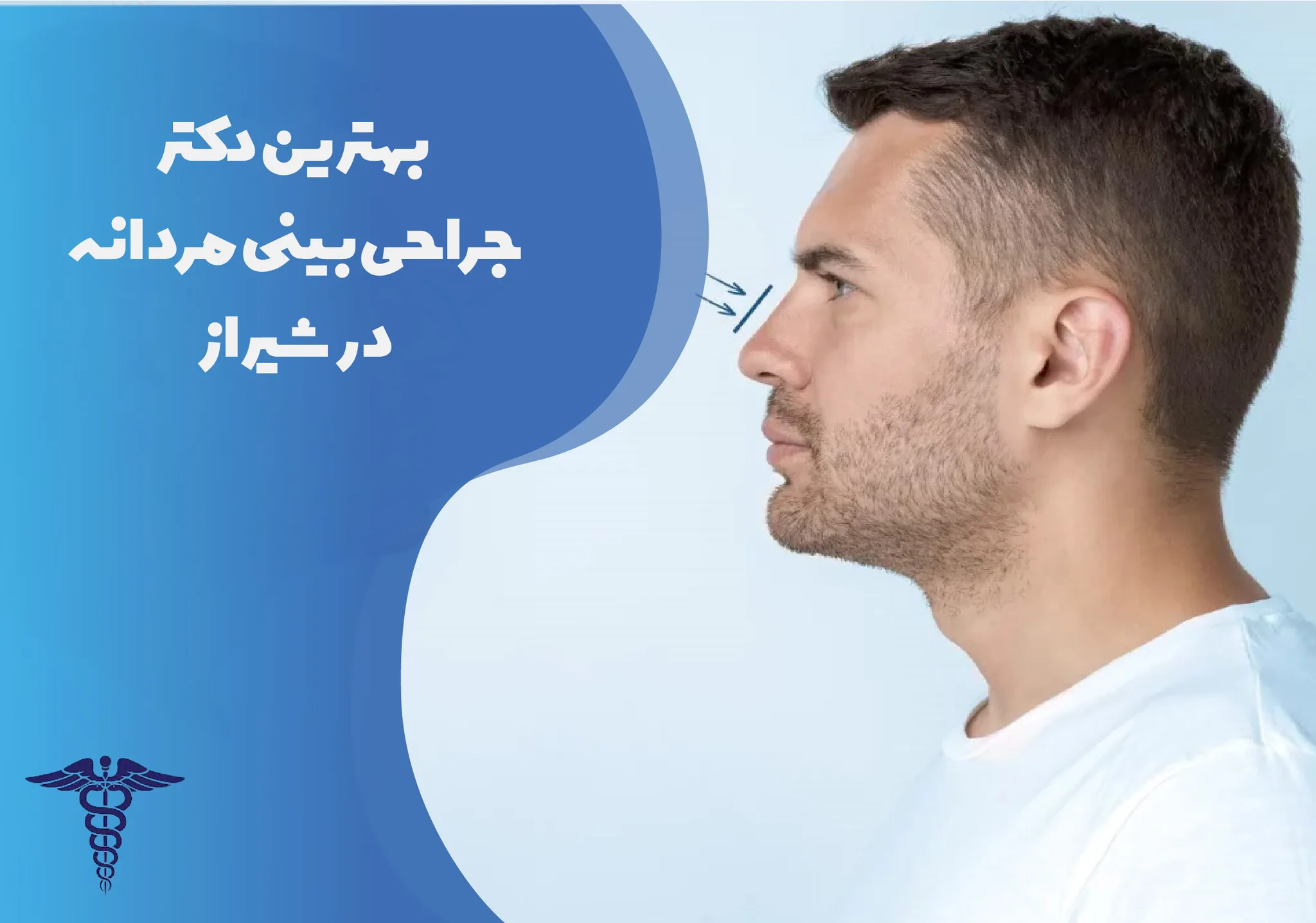 10 بهترین دکتر عمل بینی مردانه در شیراز + اینستاگرام و هزینه ۱۴۰۵