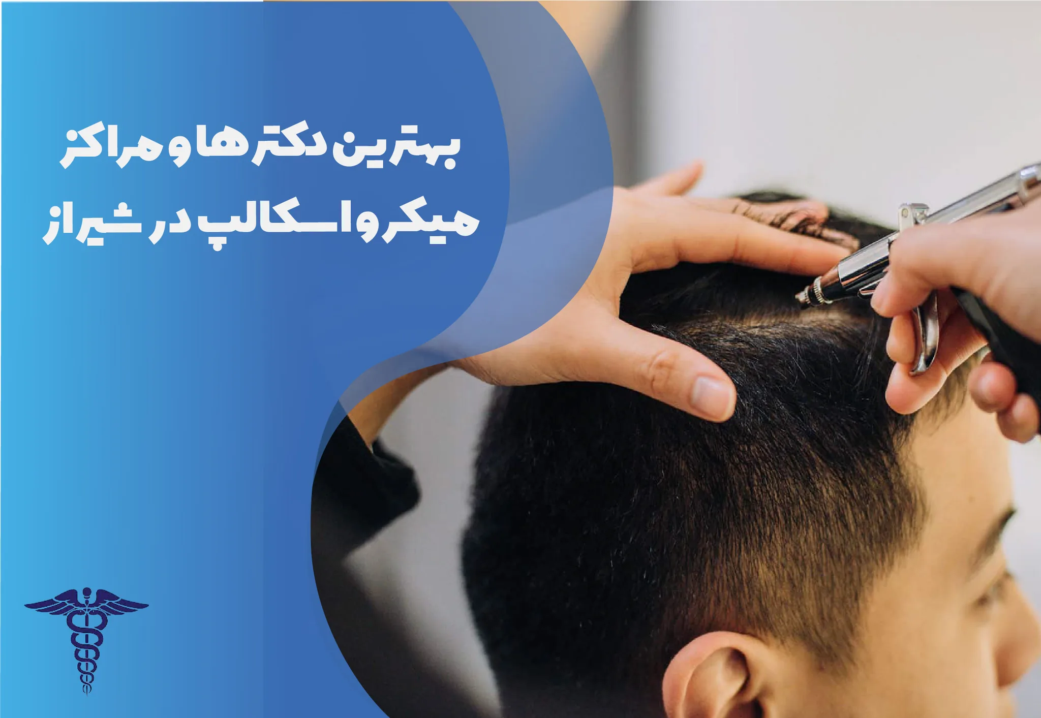 معرفی 12 مرکز برتر میکرو اسکالپ در شیراز – بهترین مرکز میکرو اسکالپ شیراز کجاست؟