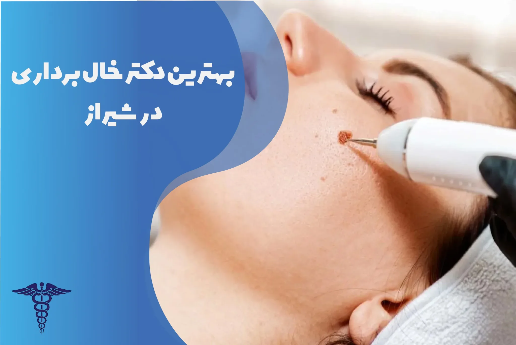 معرفی 12 دکتر برتر خال‌برداری در شیراز – بهترین دکتر خال‌برداری شیراز کیست؟