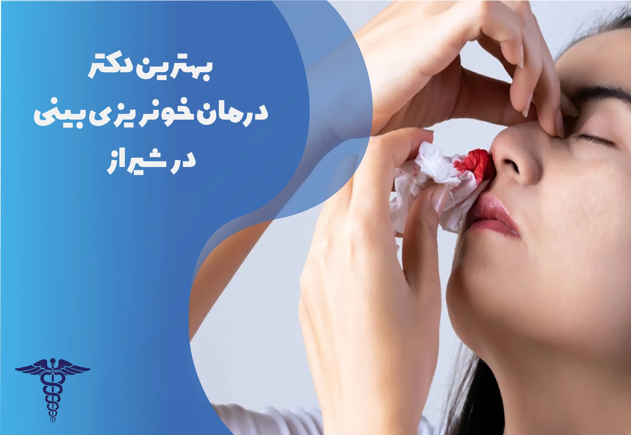 معرفی 15 دکتر برتر درمان خونریزی بینی در شیراز – بهترین دکتر خونریزی بینی شیراز کیست؟