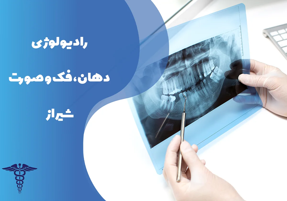 رادیولوژی دهان، فک و صورت شیراز - راهنمای کامل انواع خدمات، قیمت و نکات مهم