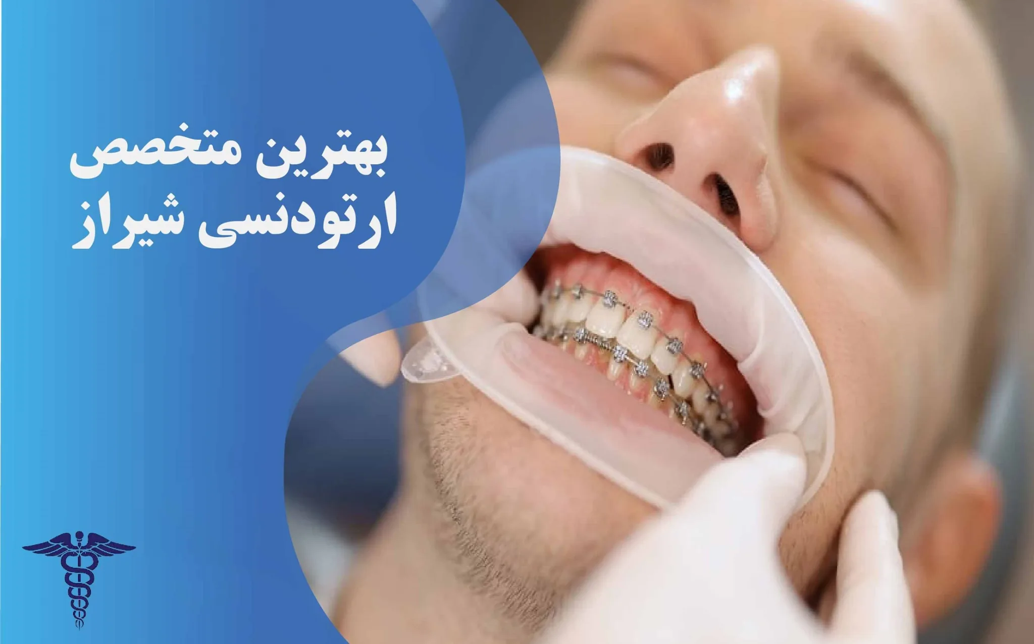 معرفی 22 متخصص ارتودنسی برتر شیراز - بهترین متخصص ارتودنسی شیراز کیست؟