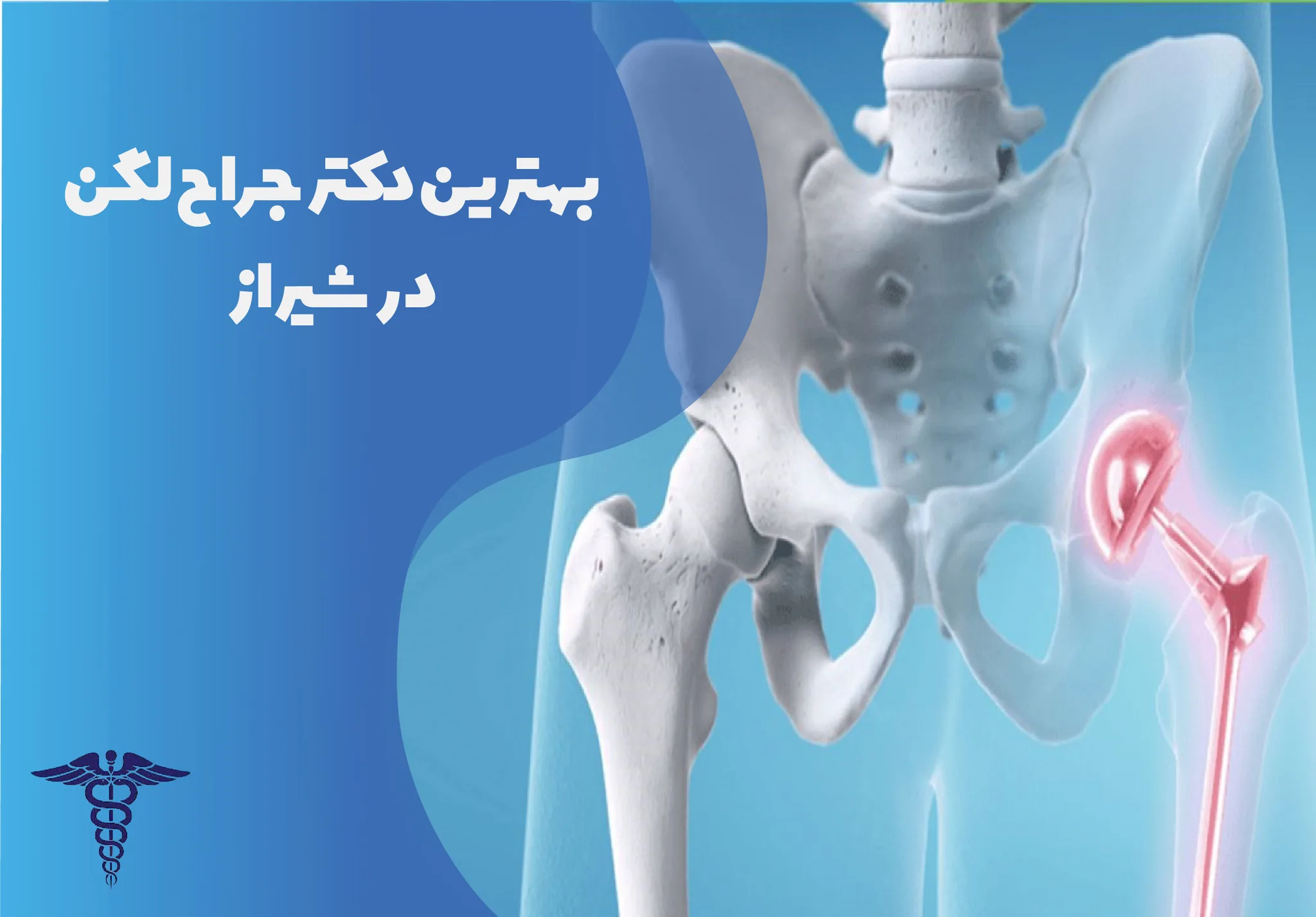 معرفی 12 جراح برتر لگن در شیراز – بهترین جراح لگن شیراز کیست؟