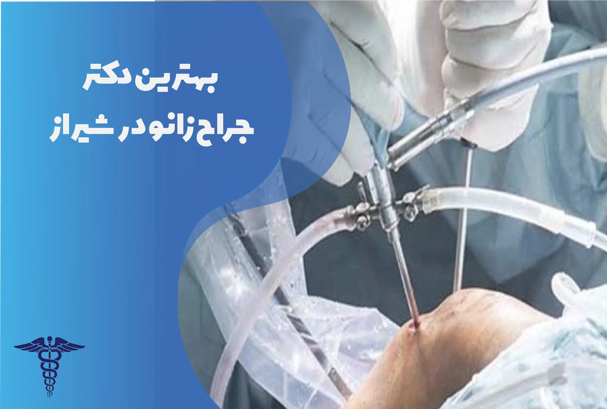 معرفی 12 جراح برتر زانو در شیراز – بهترین جراح زانو شیراز کیست؟