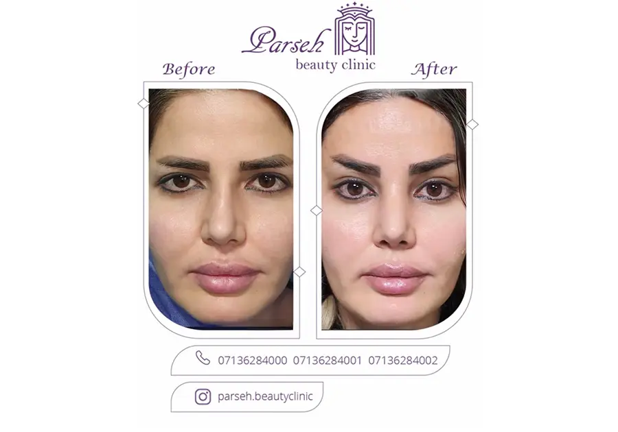 کلینیک پارسه ، بهترین کلینیک لیفت اندوسکوپیک در شیراز