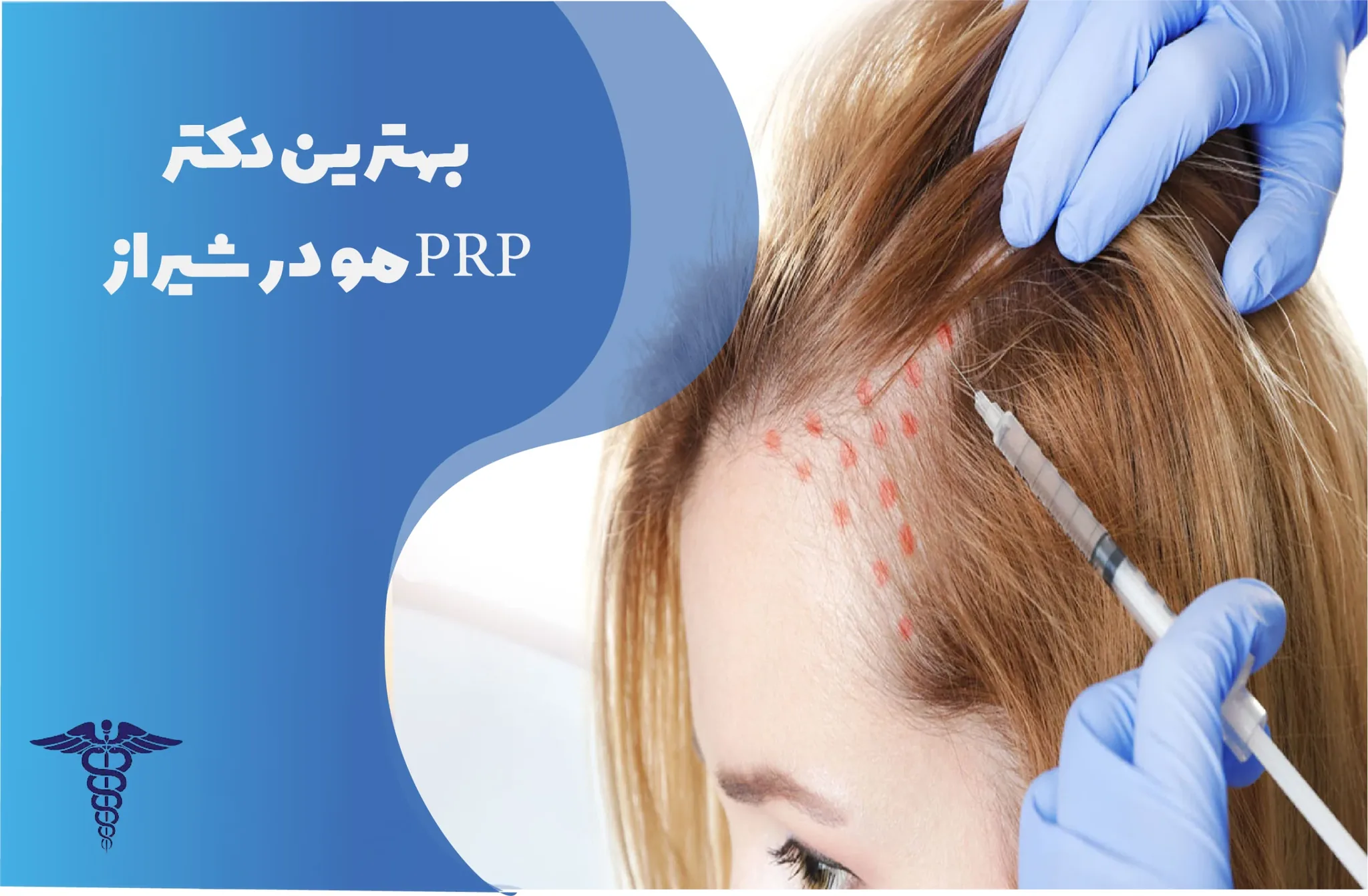 معرفی 12 دکتر برتر PRP مو در شیراز – بهترین دکتر PRP مو شیراز کیست؟