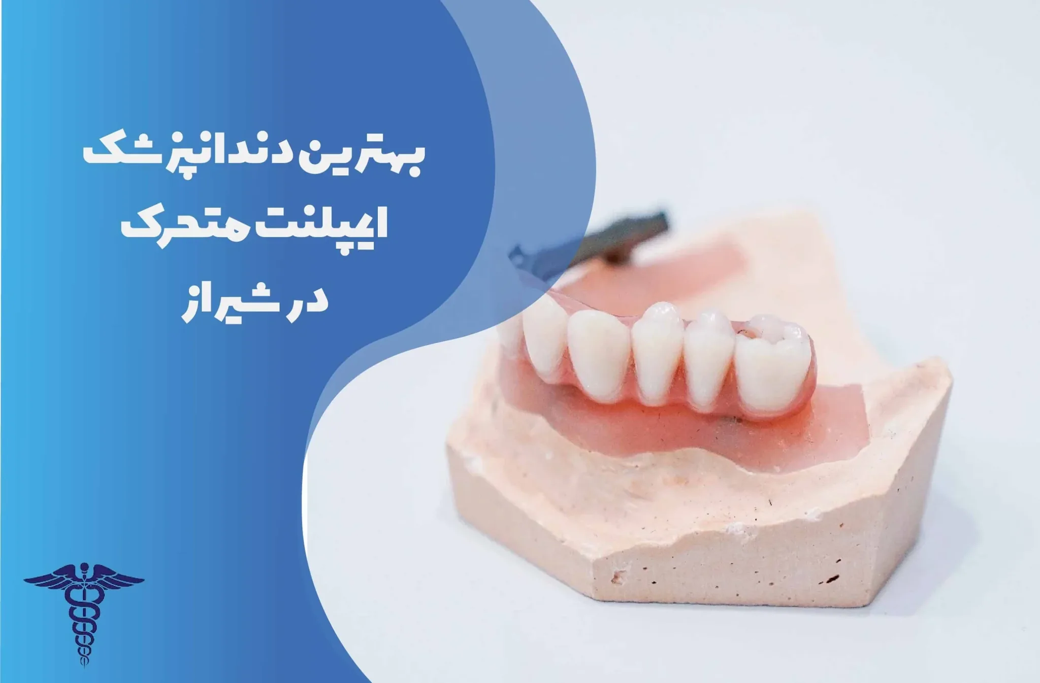 معرفی 25 دندانپزشک برتر ایمپلنت متحرک در شیراز - بهترین دندانپزشکان ایمپلنت متحرک در شیراز کداماند؟