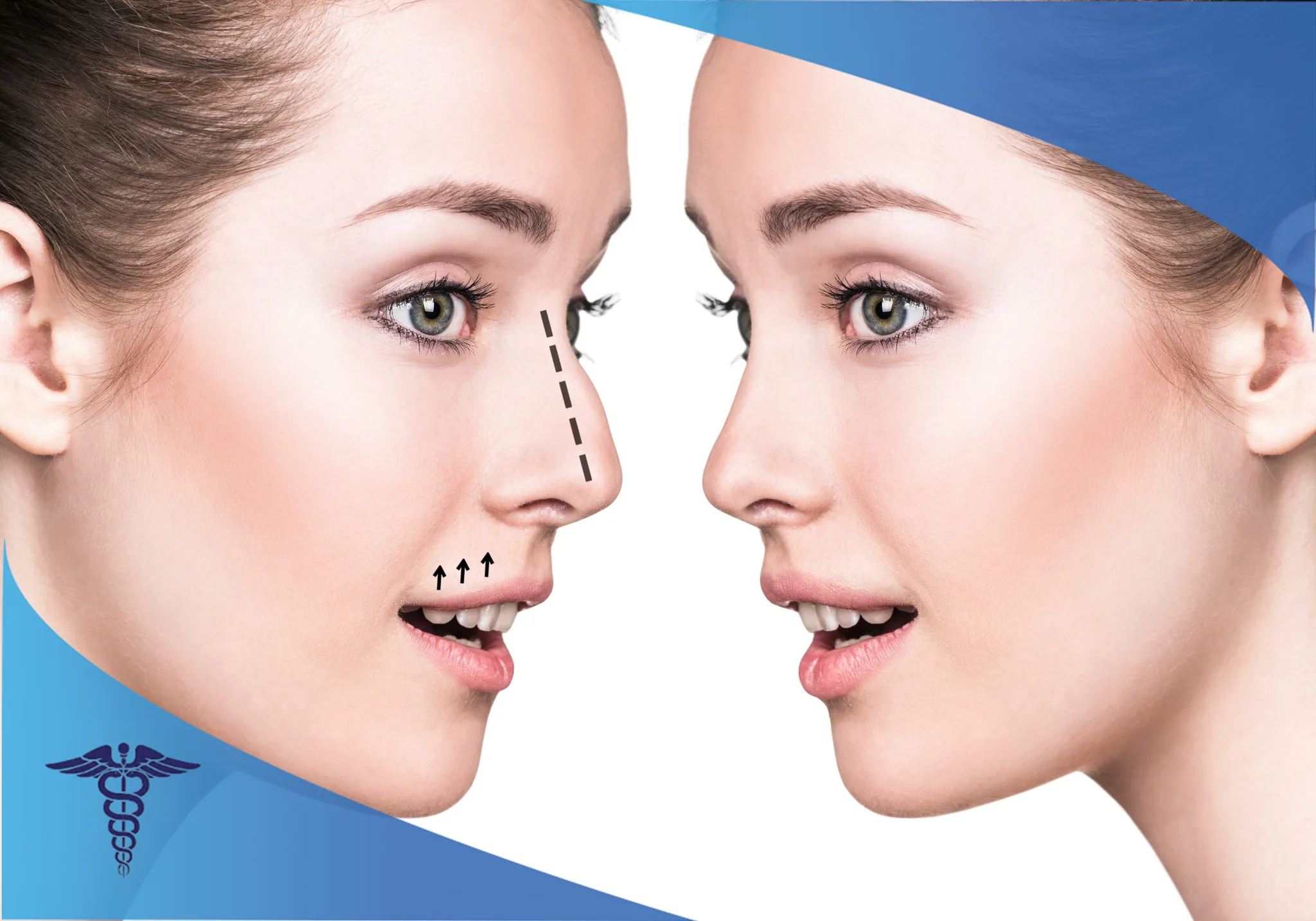بهترین پزشکان جراحی بینی در صدرا شیراز