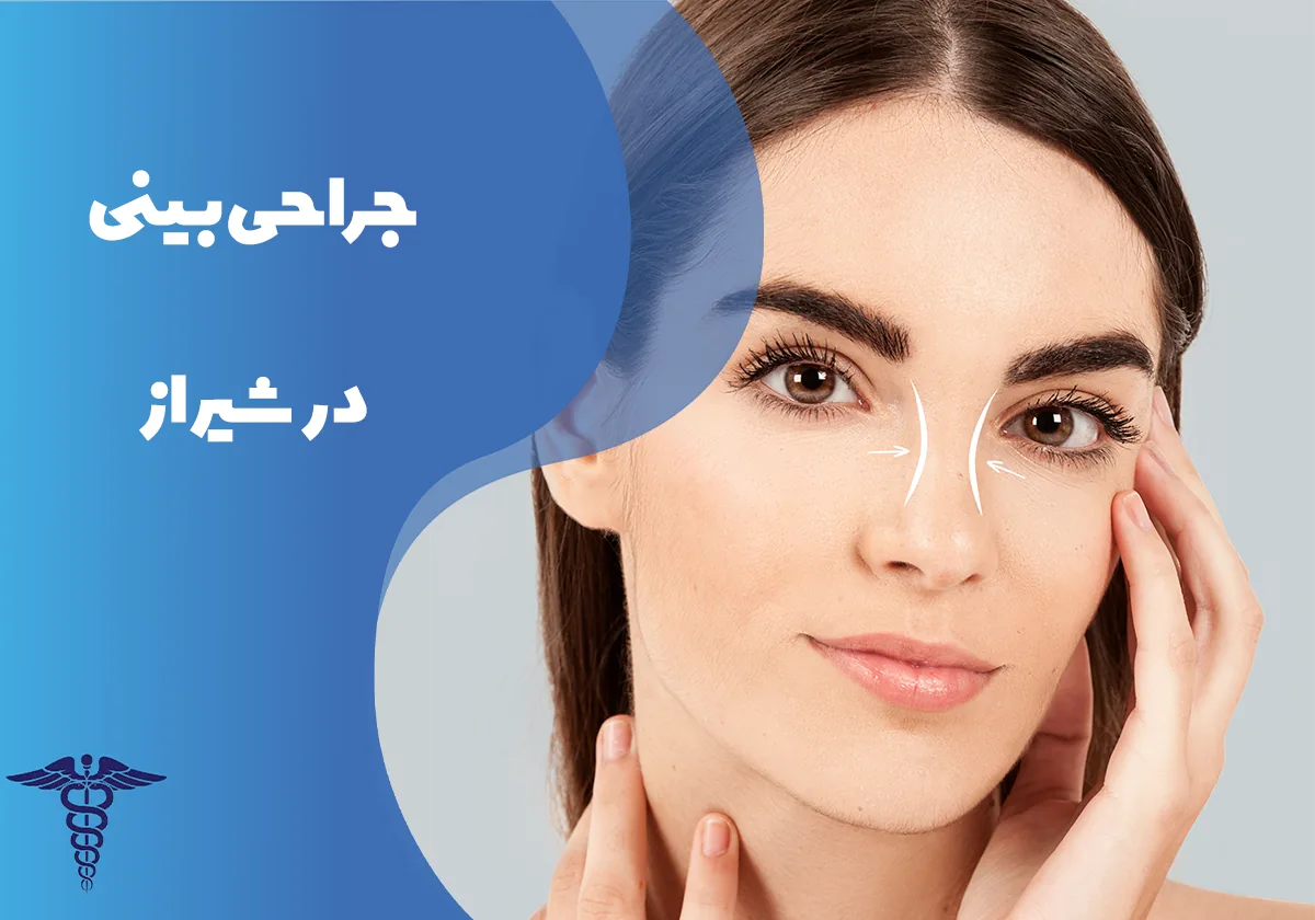 جراحی بینی در شیراز - راهنمای کامل مراحل، هزینه و مراقبتهای بعد از عمل بینی