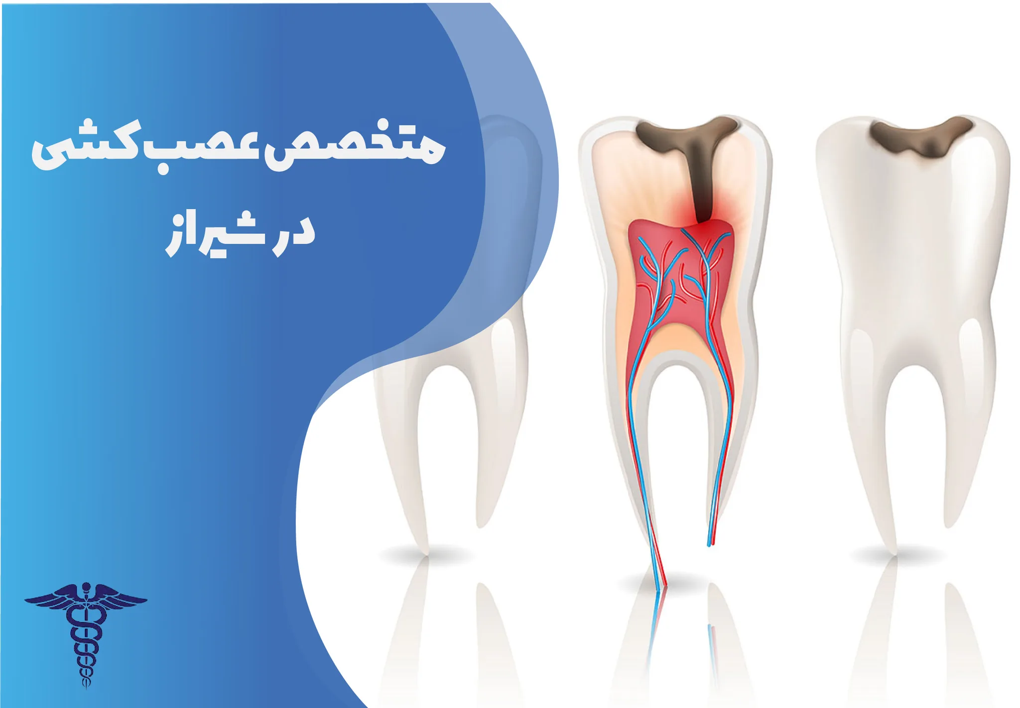 بهترین دکتر عصب کشی دندان در شیراز