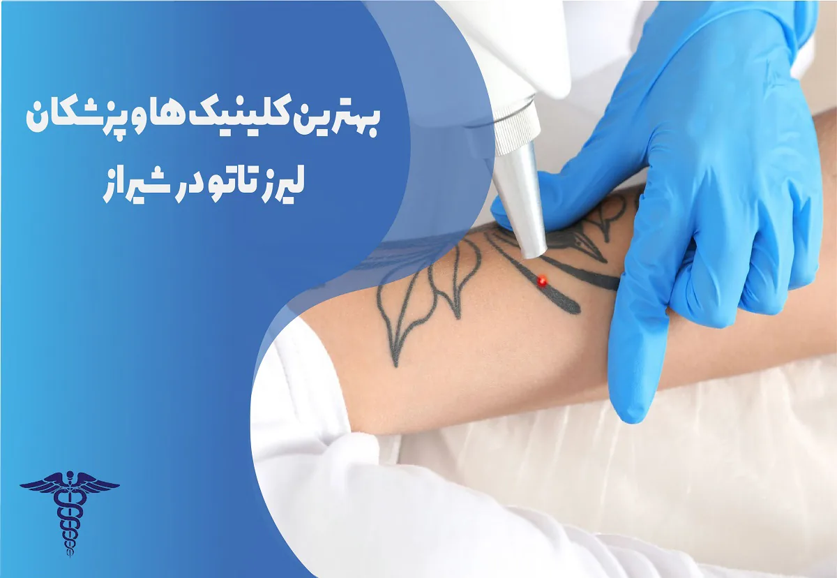 ۱۰ بهترین کلینیک لیزر حذف تاتو در شیراز + هزینه ۱۴۰۵