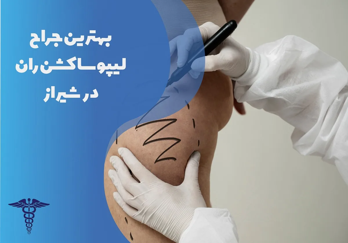 معرفی 12 جراح لیپوساکشن ران در شیراز - بهترین جراح لیپوساکشن ران شیراز کیست؟
