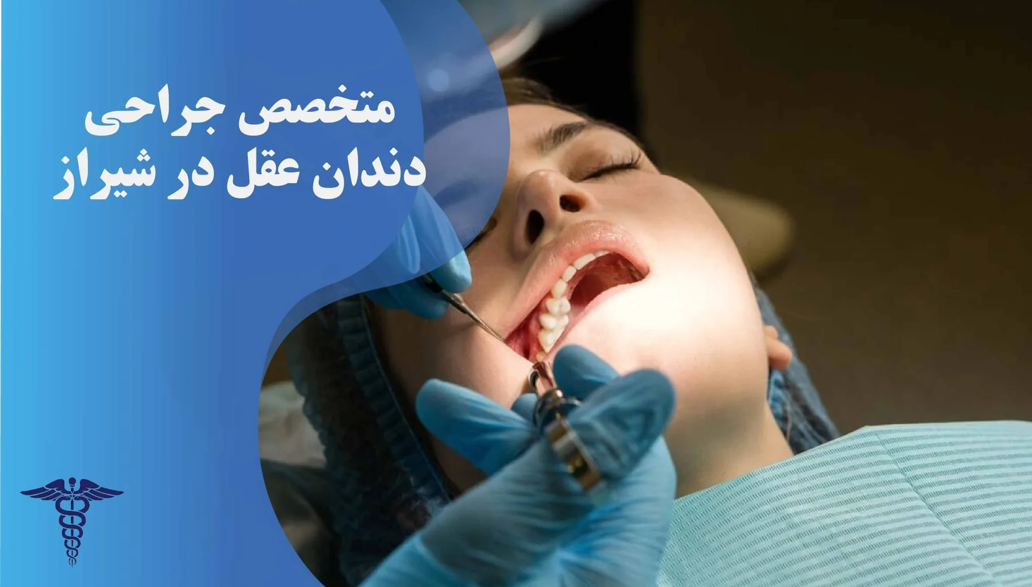 معرفی ۲۴ متخصص برتر جراحی دندان عقل در شیراز - بهترین متخصص جراحی دندان عقل در شیراز کیست؟